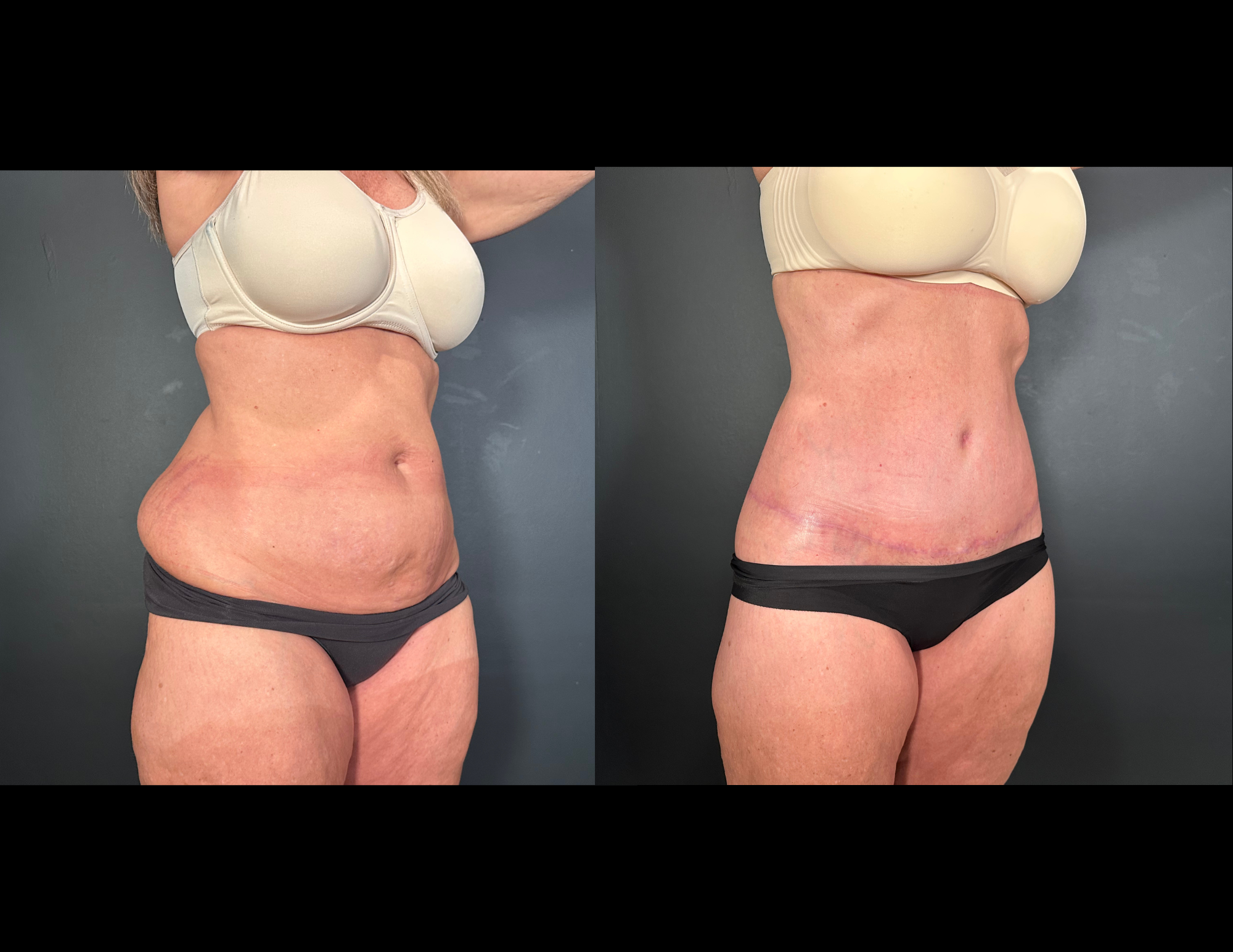 Before & After Photos (2).png