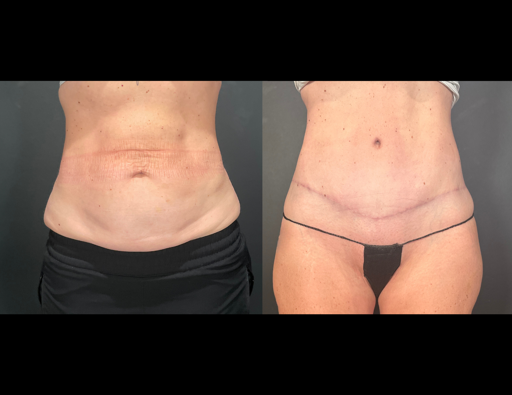 Before & After Photos (17).png