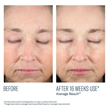 PDP_MystroRevive_8_BeforeAfter_2000x2000_V2_929.webp