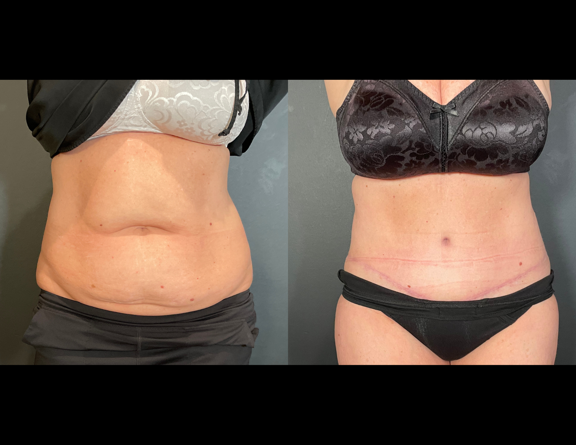 Before & After Photos (29).png