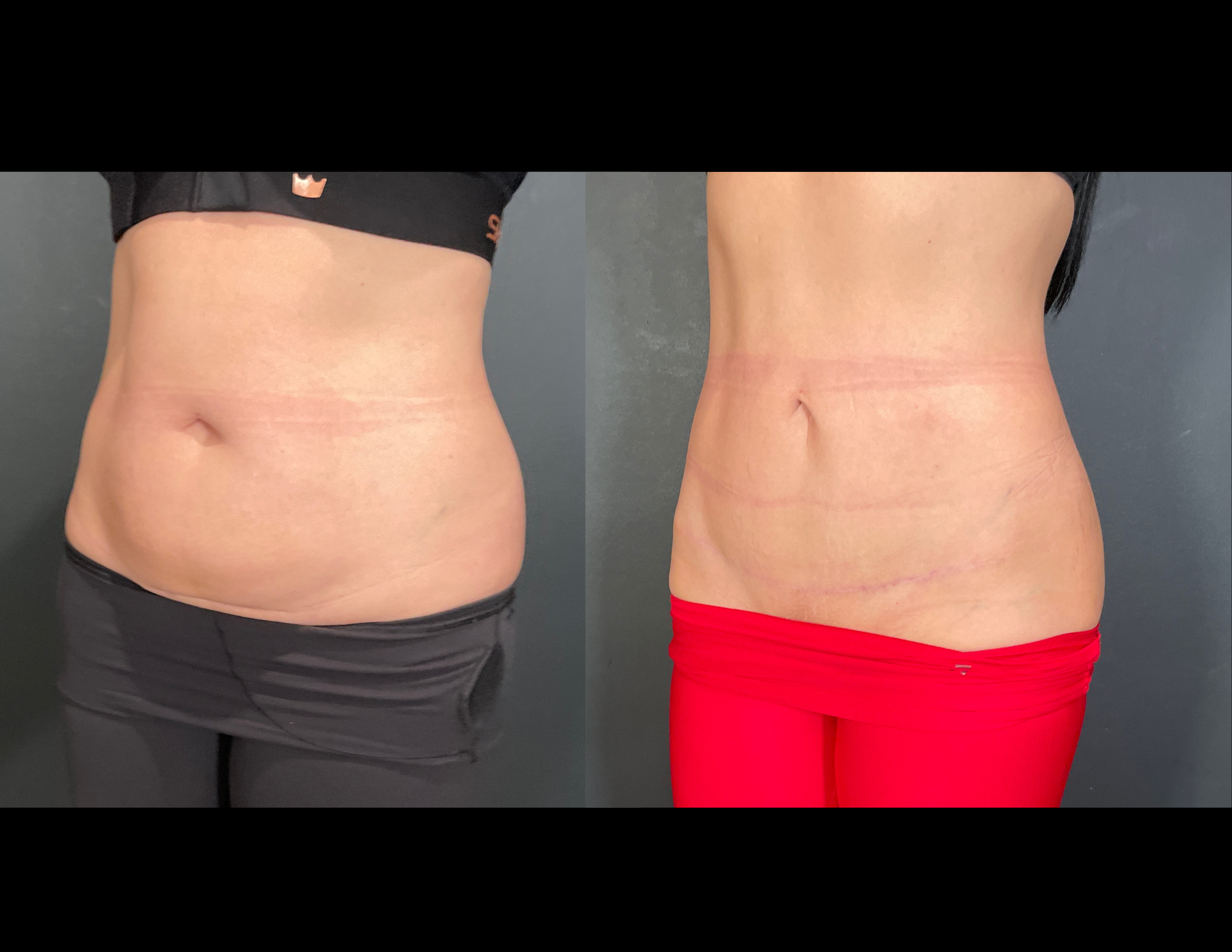 Before & After Photos (22).png