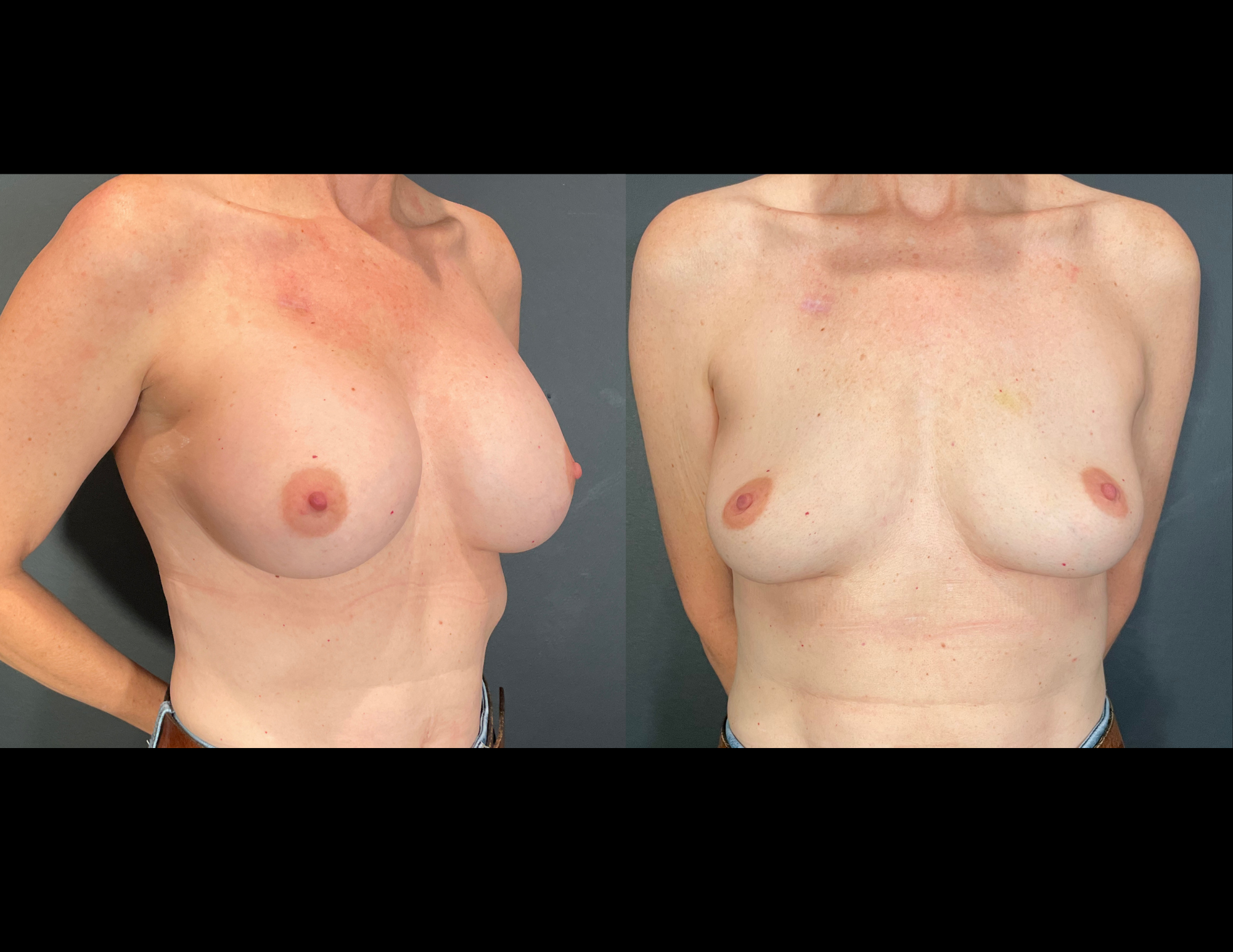 Before & After Photos (57).png