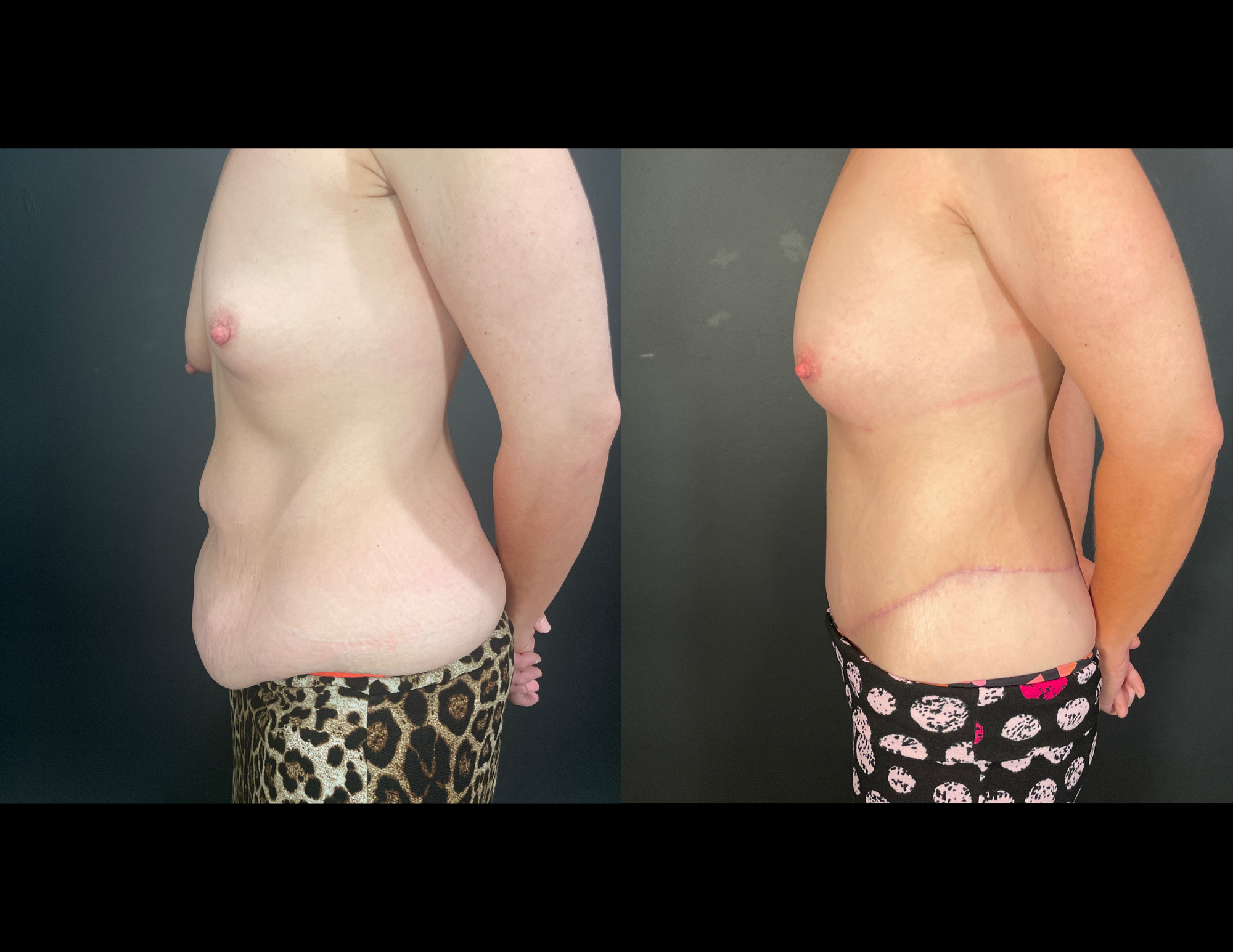 Before & After Photos (27).png