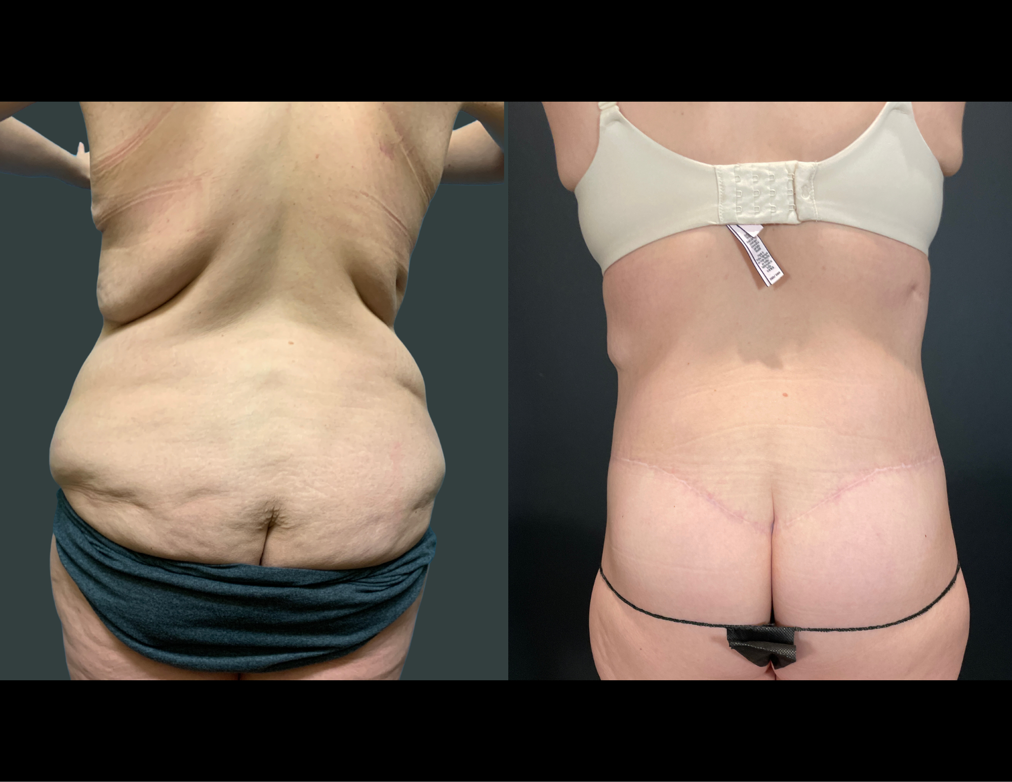 Before & After Photos (38).png