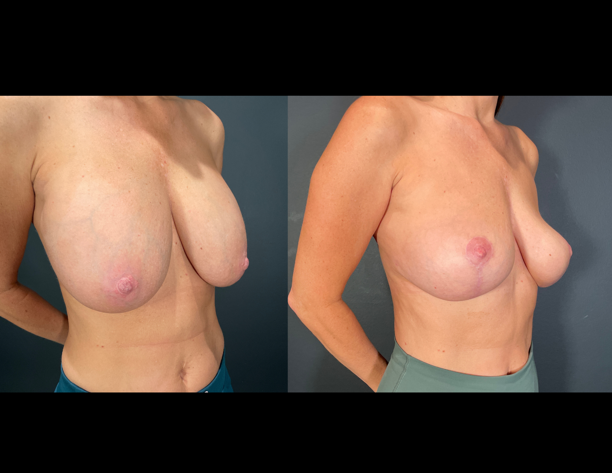 Before & After Photos (47).png
