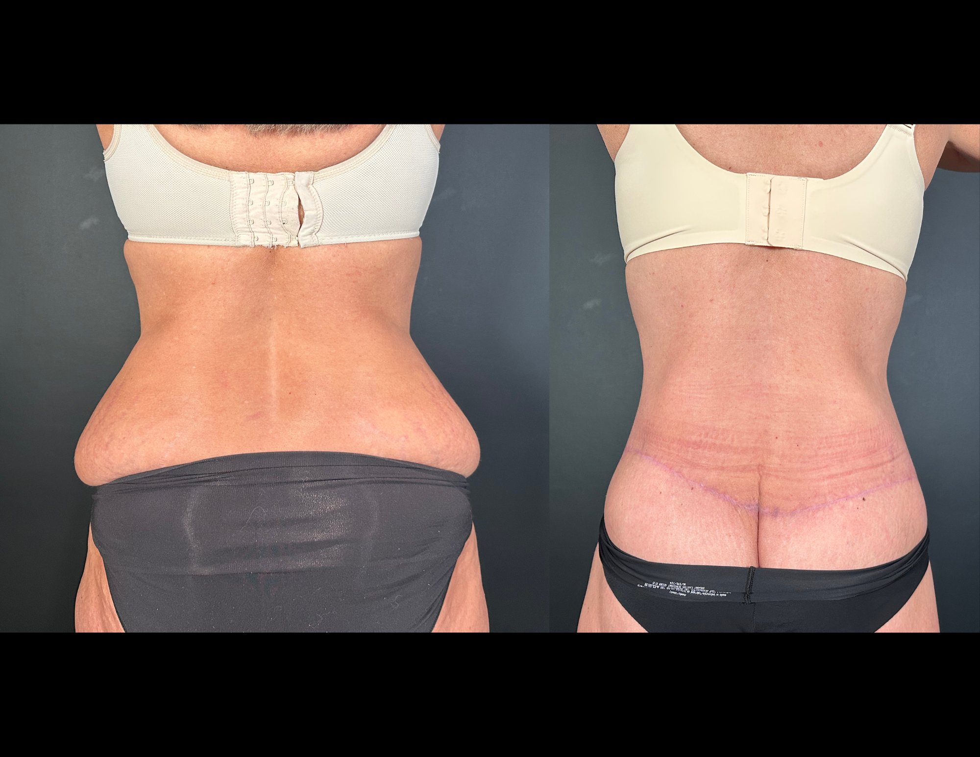 Before & After Photos (6).png