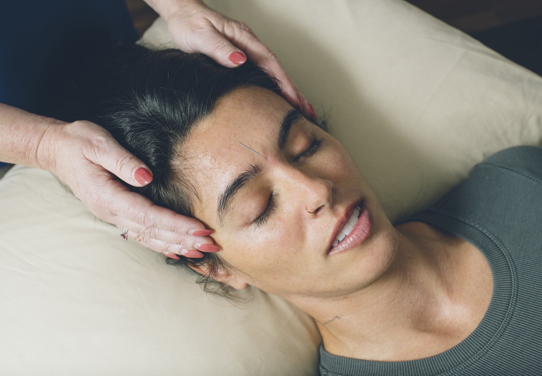 Acupuncture’s Healing Benefits