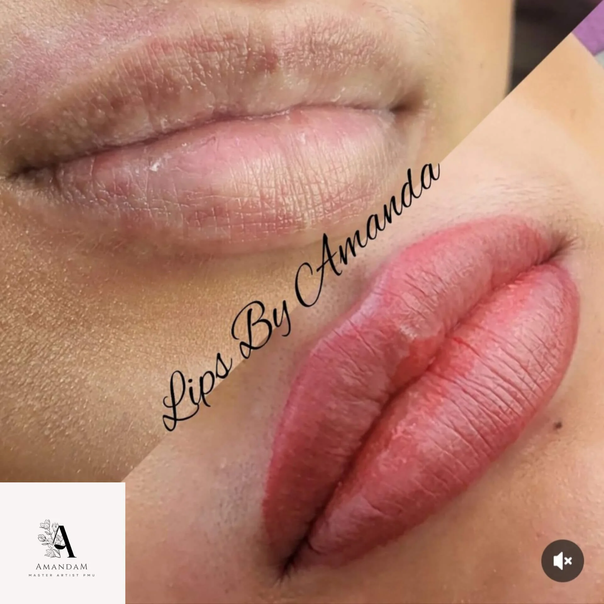 Close-up of lips, showing before and after cosmetic lip enhancement, with the text 'Lips By Amandam'a' written across. The bottom lip appears fuller and more defined after the procedure.