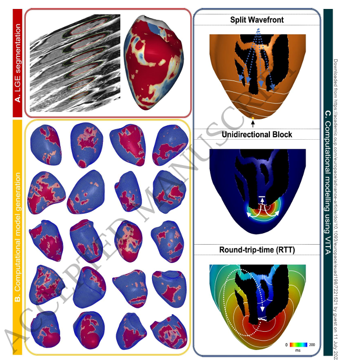 Arrhythmogenic Vulnerability of Reentrant Pathways in Post-Infarct Ventricular Tachycardia Assessed