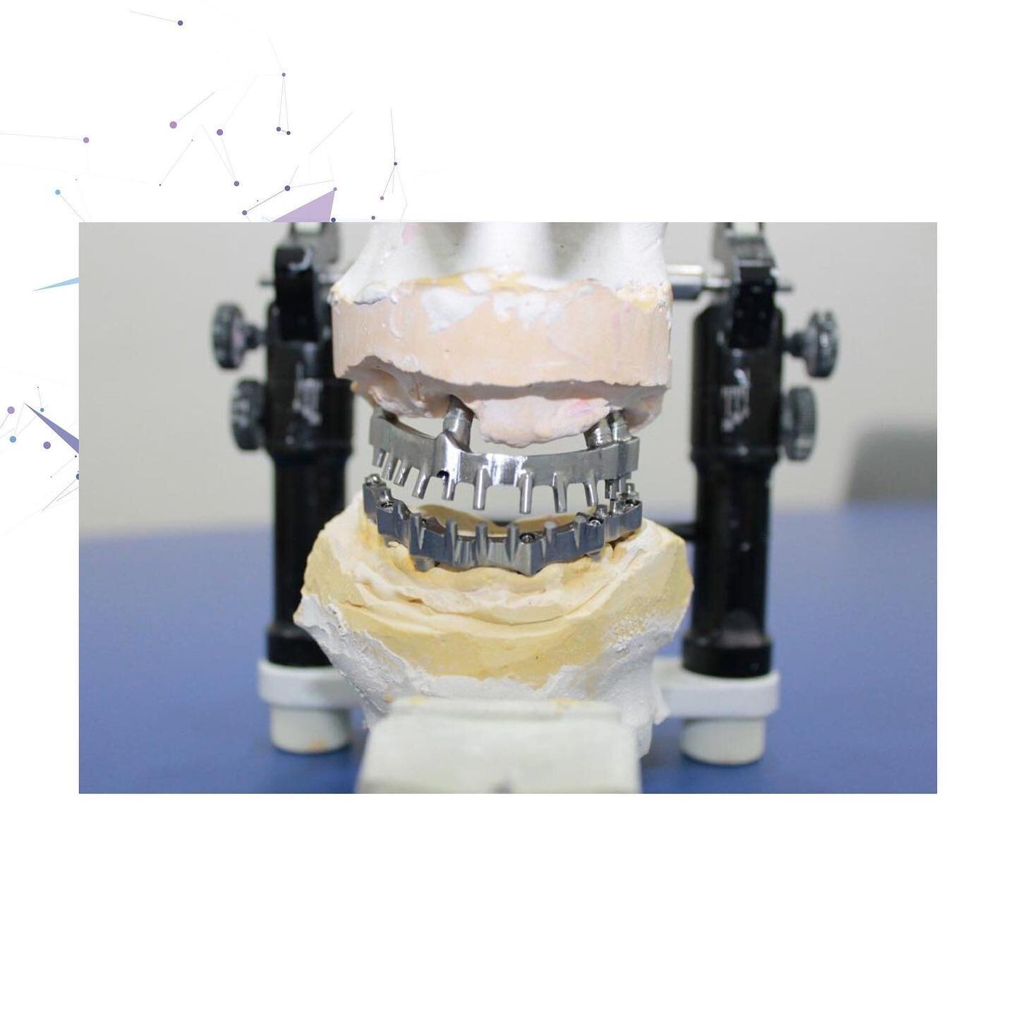 𝘽𝙖𝙧𝙧𝙖 𝙞𝙣 𝙏𝙞𝙩𝙖𝙣𝙞𝙤
#laboratoriodental #laboratorioodontotecnico #LaserMelting #exocad #fresatura #laboratorioodonto #odontotecnico #odontotecnico #digitale #3d #studiodentistico #zirconio #zirconia
#tecnologia #quality #qualit&agrave; #te