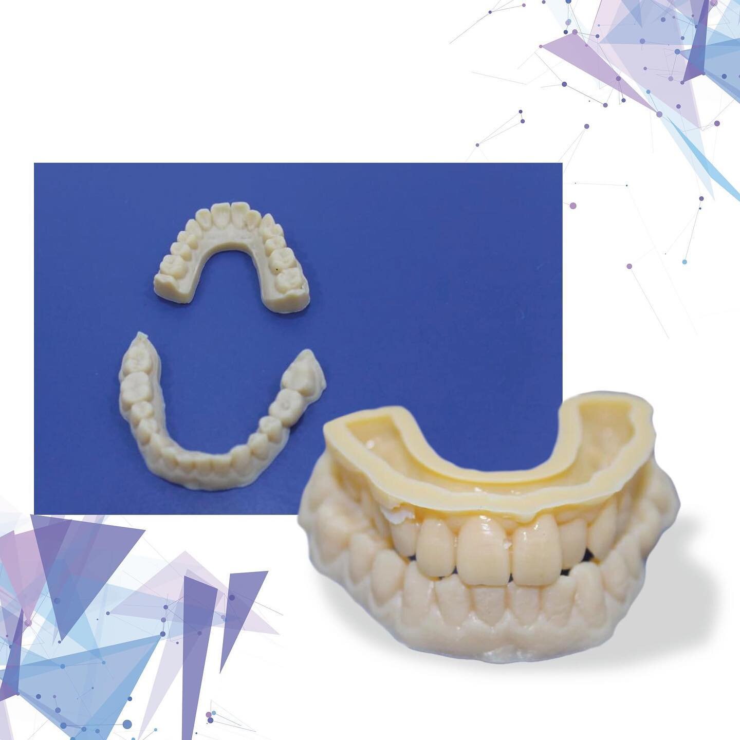 La stampa 3D consente al laboratorio odontotecnico di produrre in modo accurato e rapido corone, ponti, modelli di arcate dentali, mascherine e dime chirurgiche.

NPS MILLING utilizza una resina ad alta precisione, con incastri che supportano tollera
