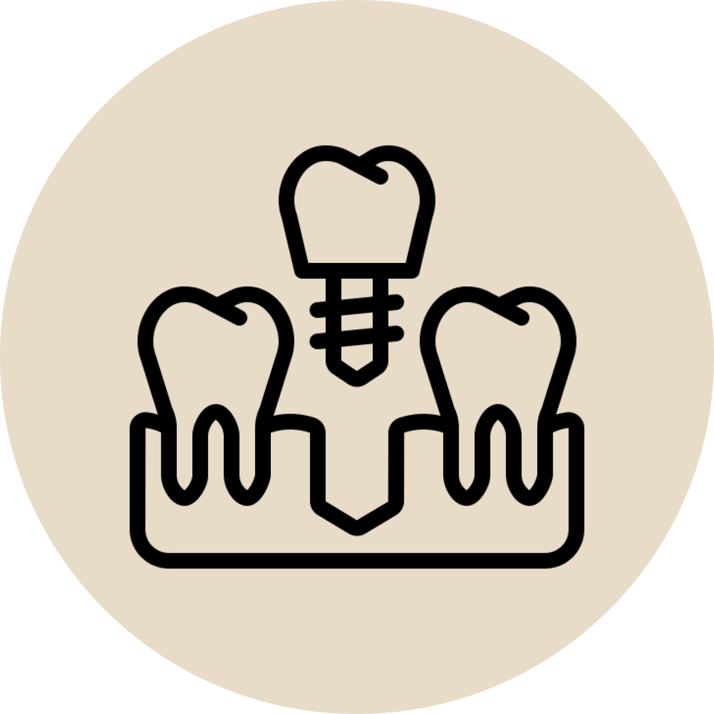 Restorative Dentistry Basha Dental