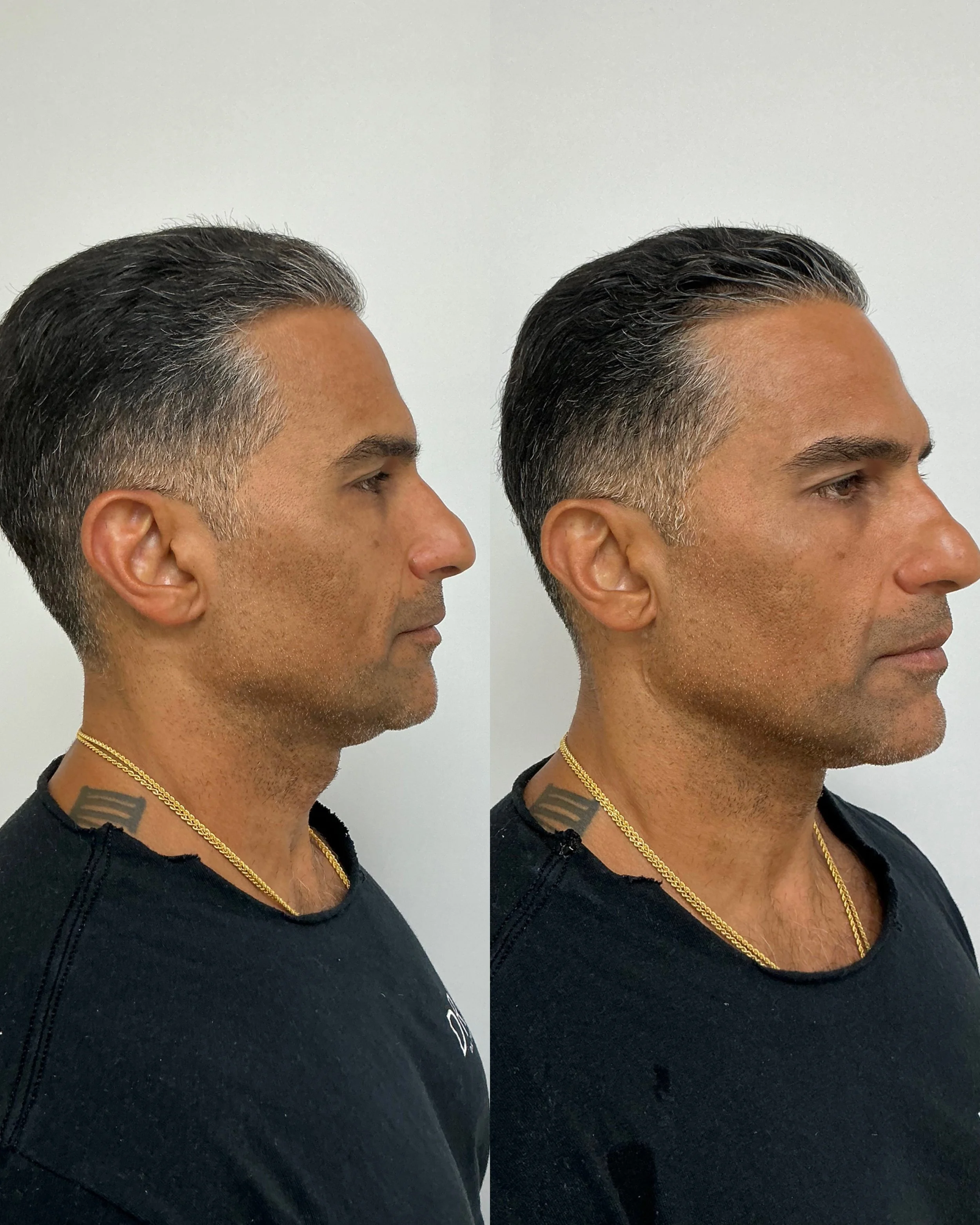 xerf treatment dearborn michigan