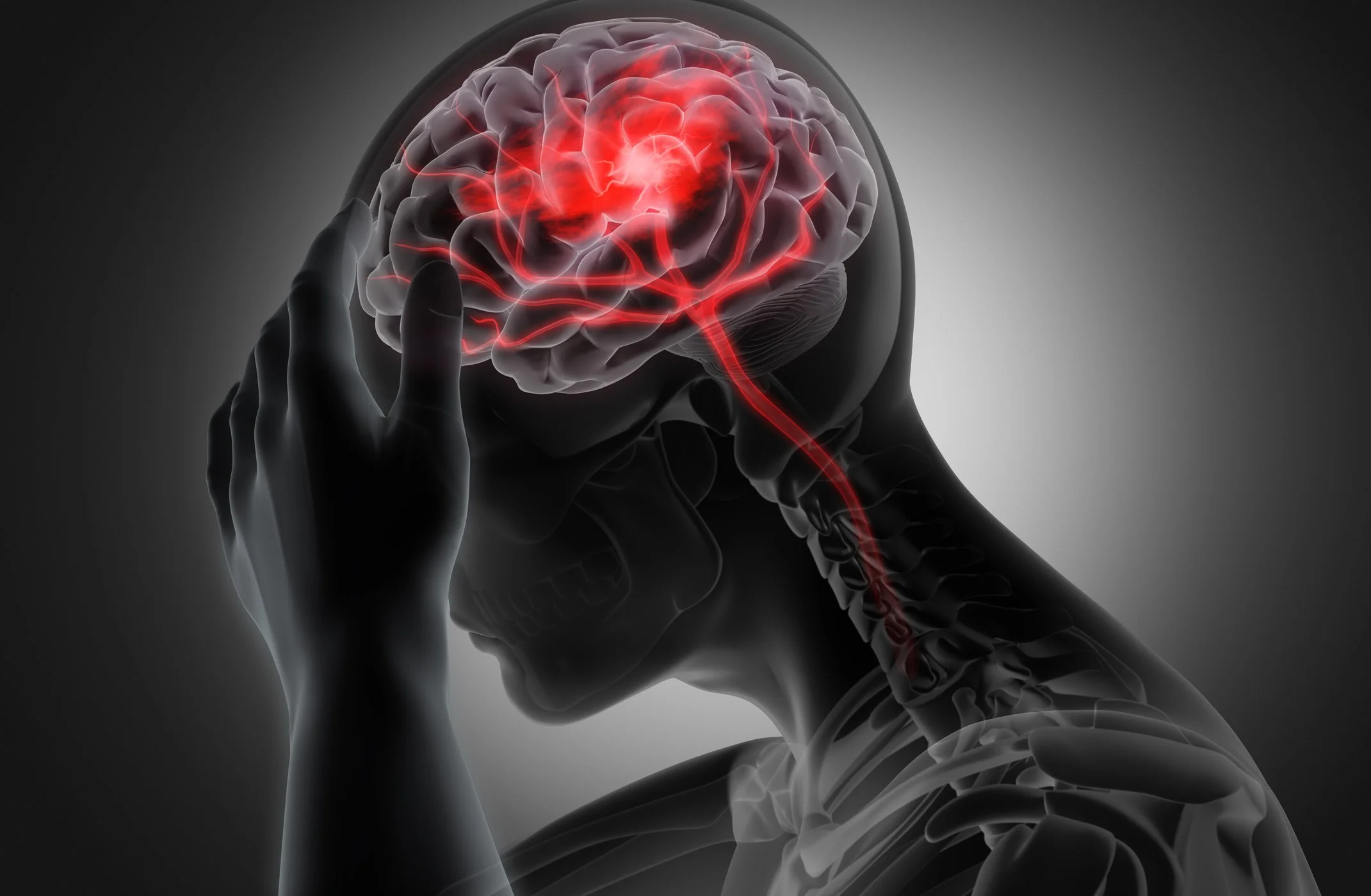 Digital illustration of a human head with a transparent skull, showing a brain with a bright red area indicating a stroke or brain injury, and red blood vessels.