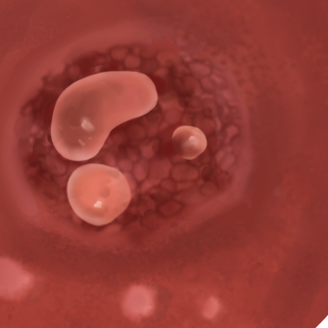 Nipple+Blister%2C+Medium+Light.png