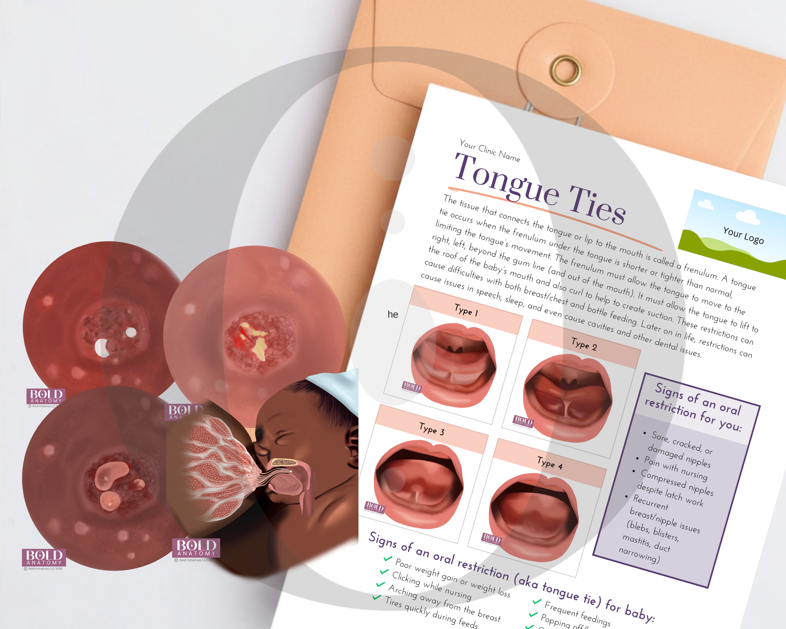Tongue Tie Bundle (15% off 8 images, 1 handout)