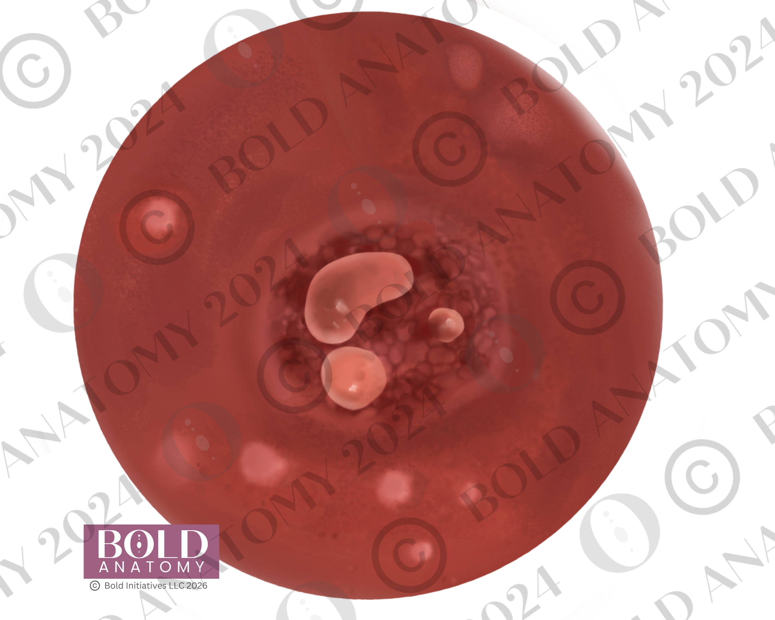 Nipple Blister, Medium Light.png