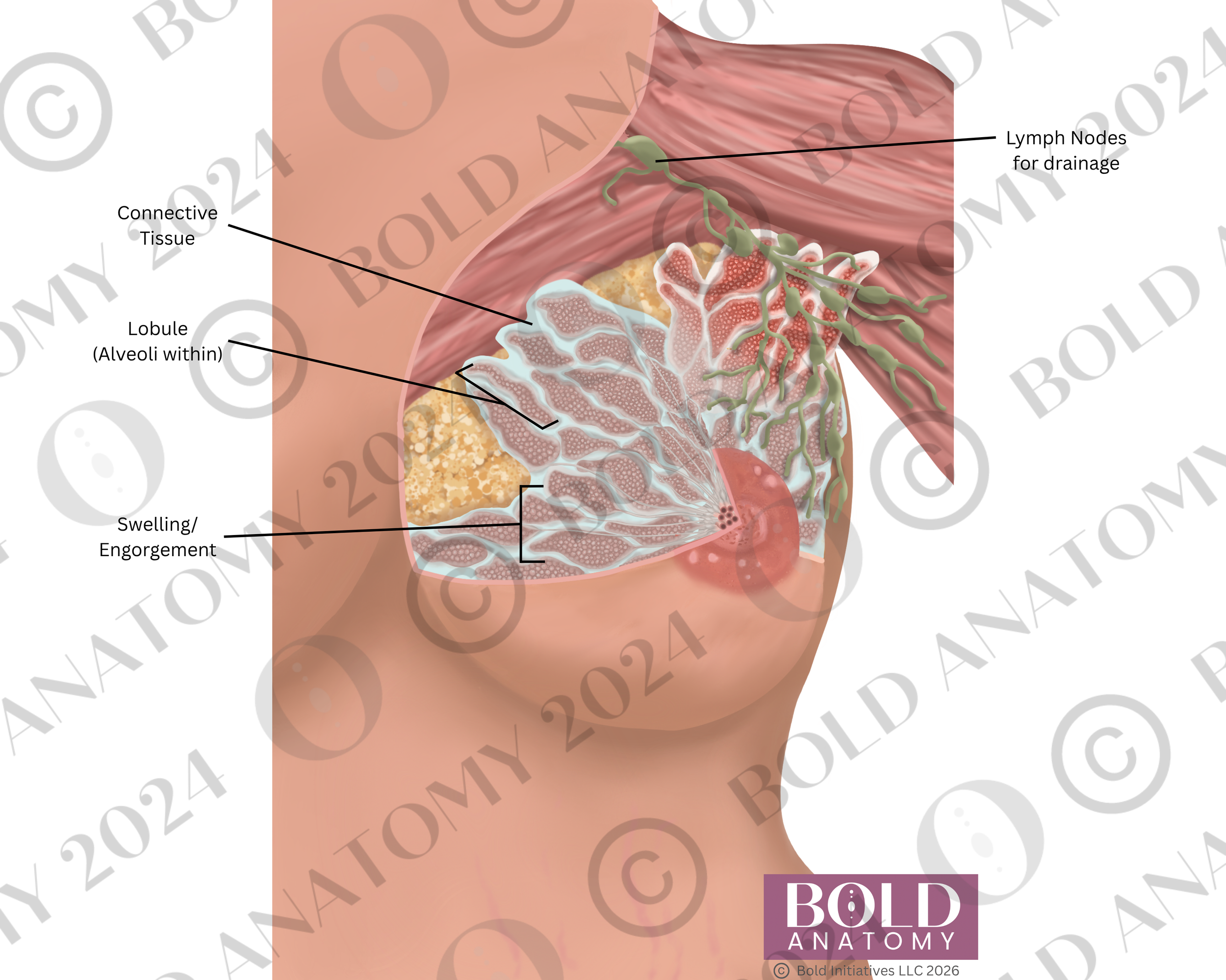 Labeled Engorgement, Lightest.png