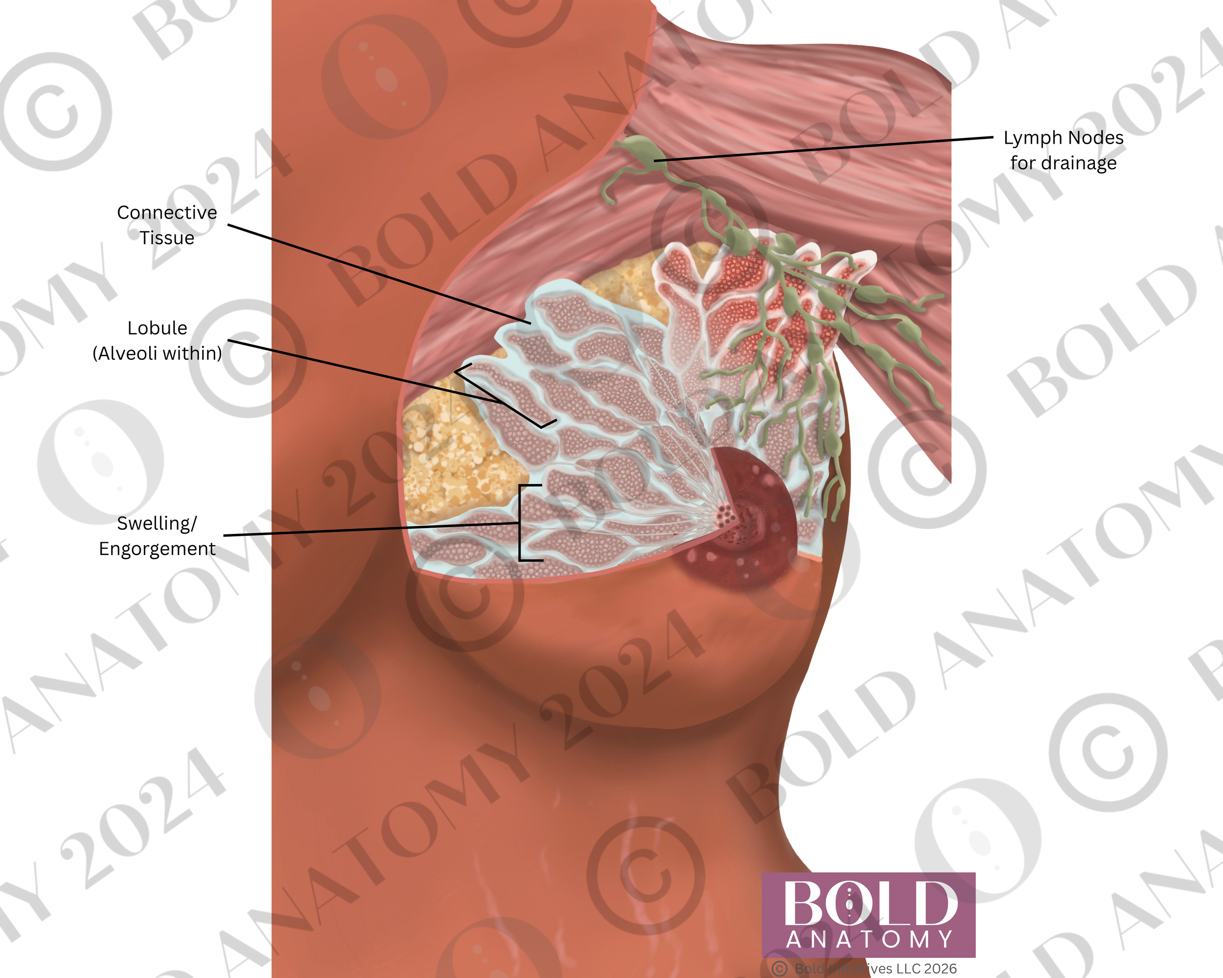 Labeled Engorgement,  Medium Dark.png