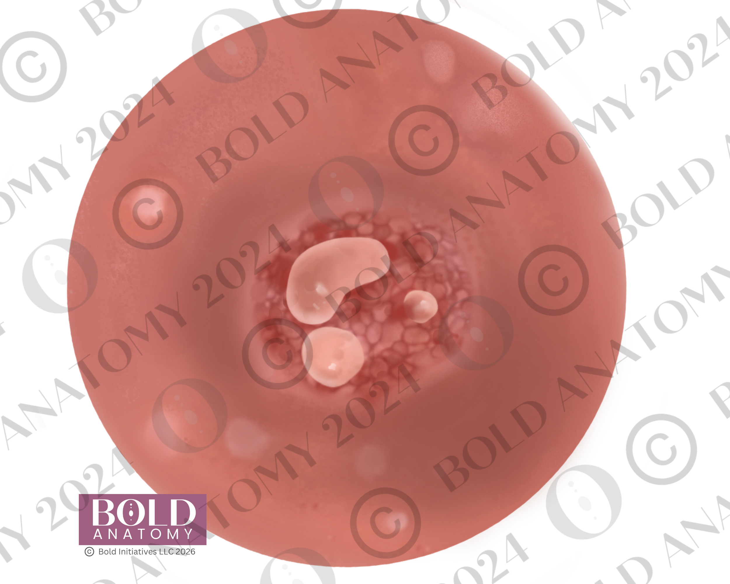 Nipple Blister, Lightest