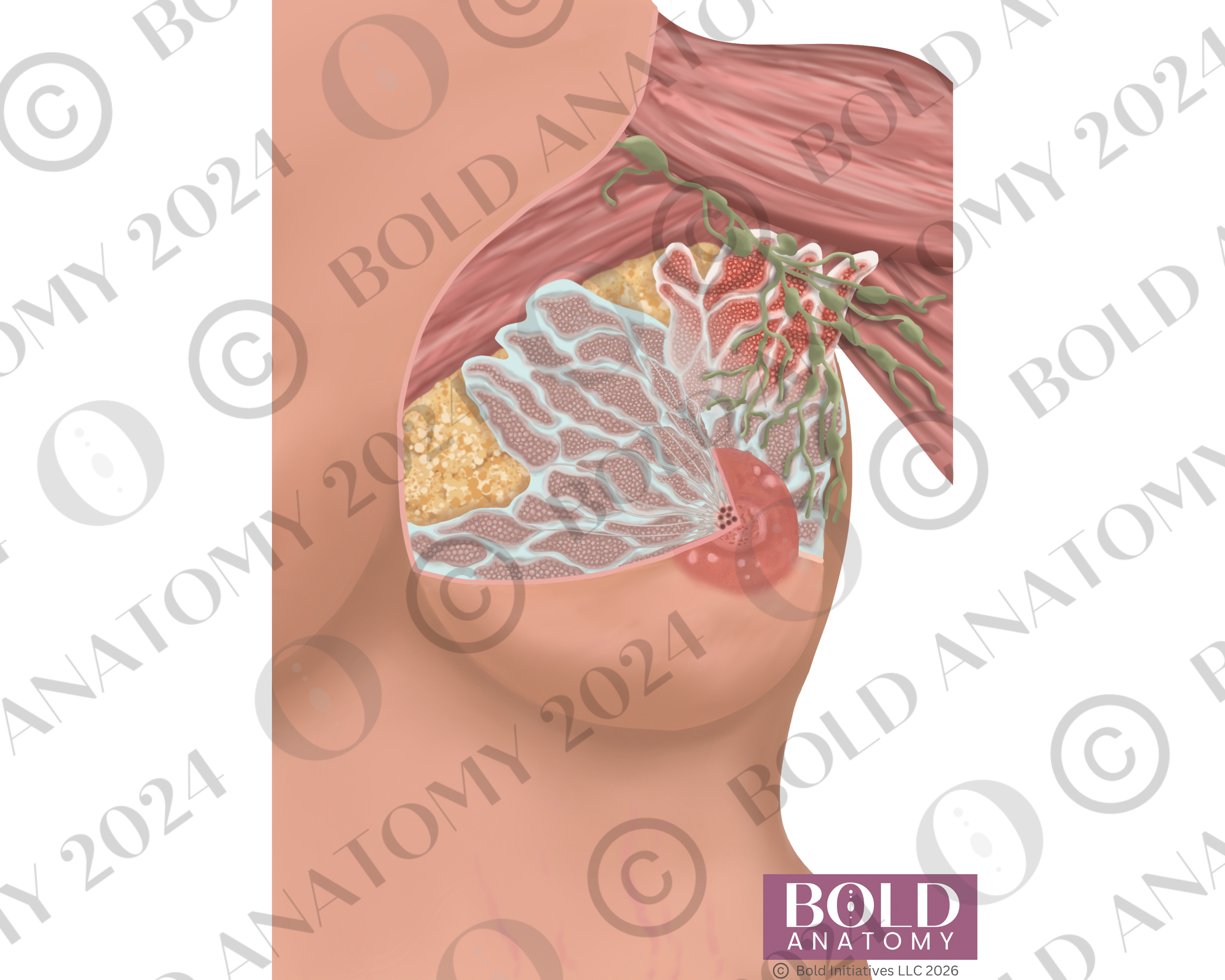 Engorgement, Lightest.png