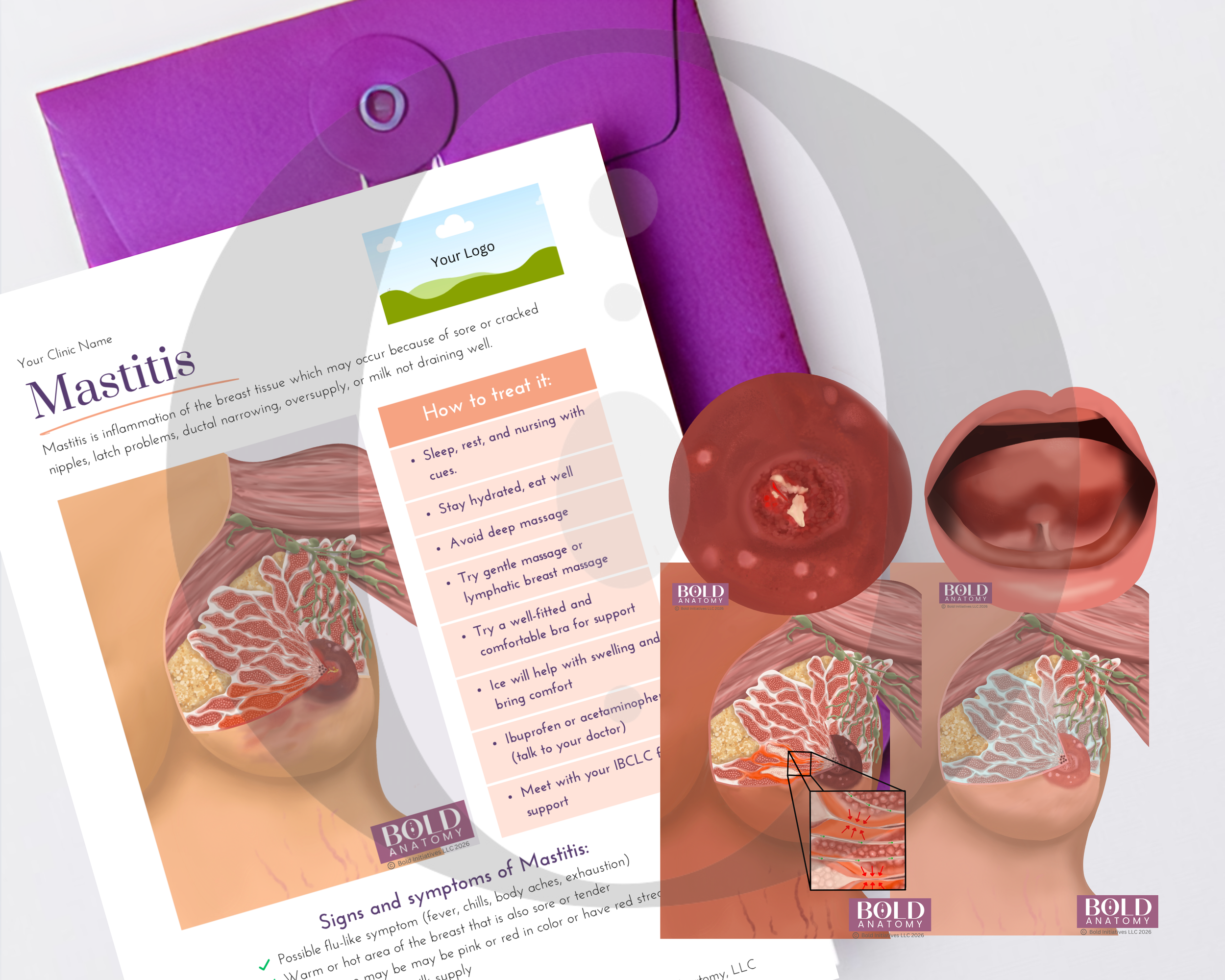Mastitis Bundle (15% off 5 images, 1 handout)