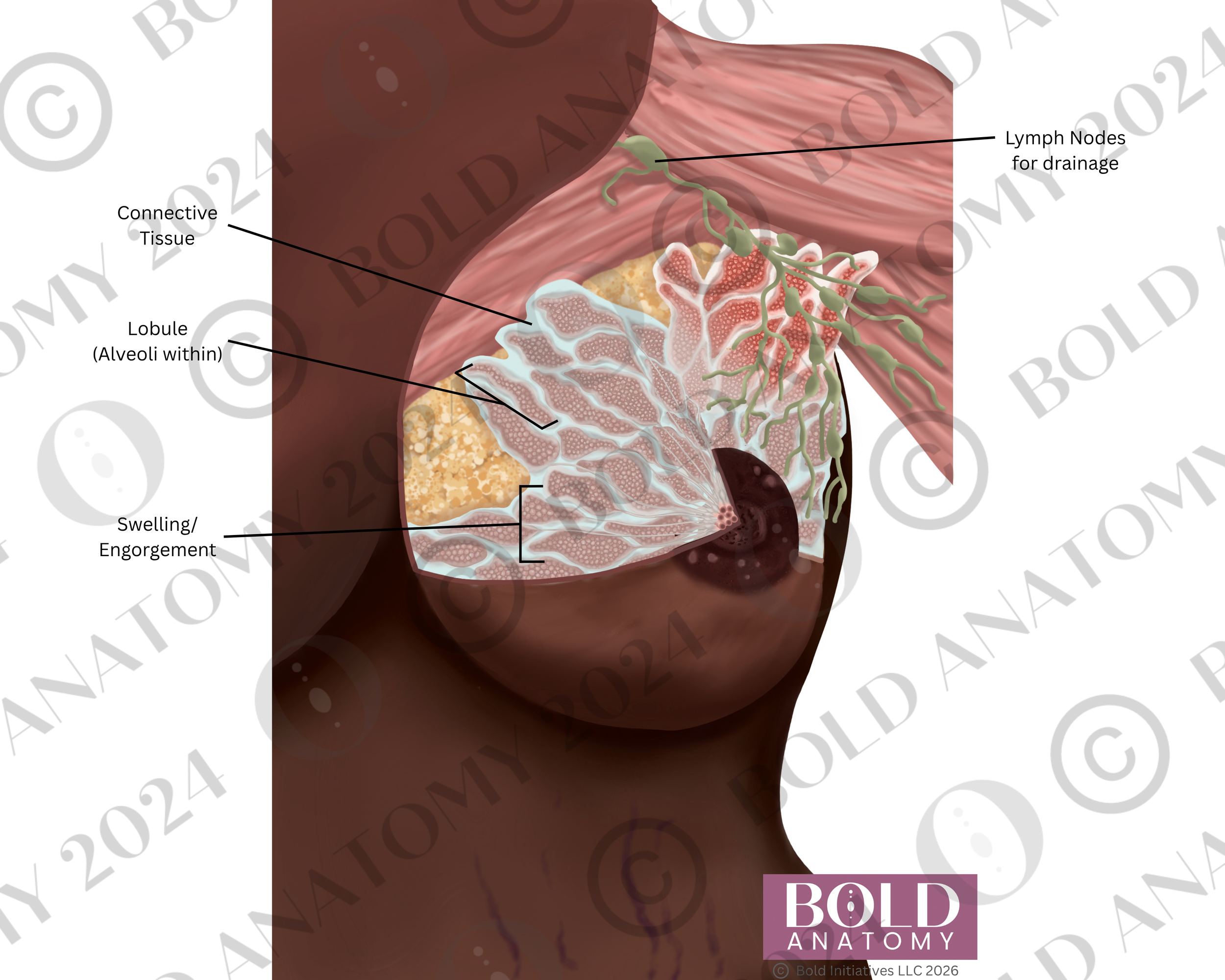 Labeled Engorgement, Darkest.png