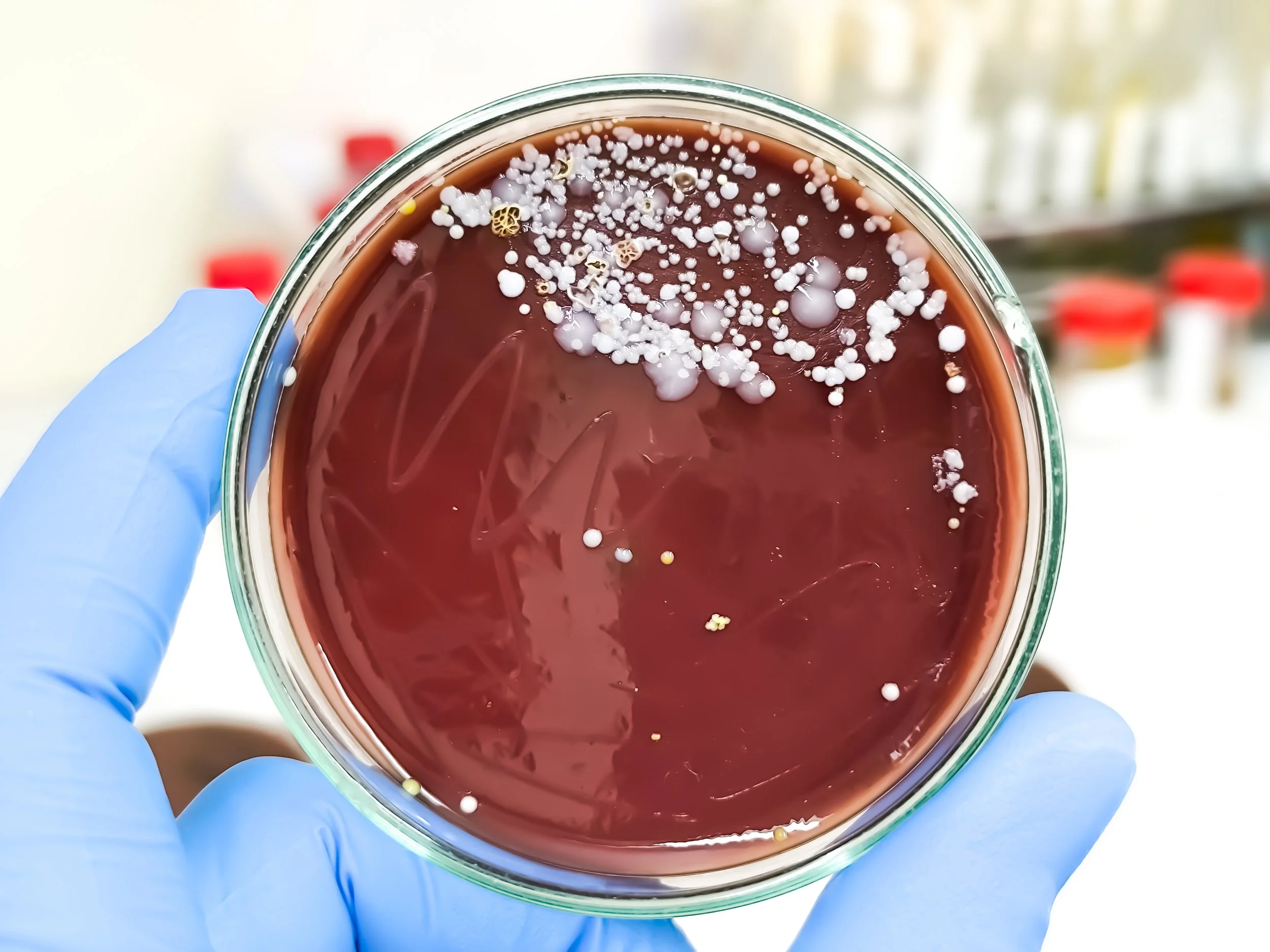 The Truth About Fermented Foods