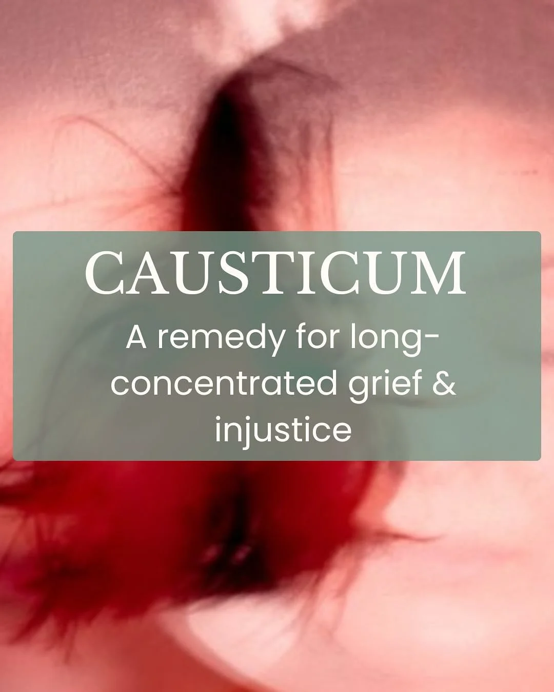 Causticum is a remedy that is frequently overlooked, yet it is highly effective for chronic, slowly progressive conditions affecting both mind and body. It is particularly useful in the young and the elderly, or in any case where disease develops gra