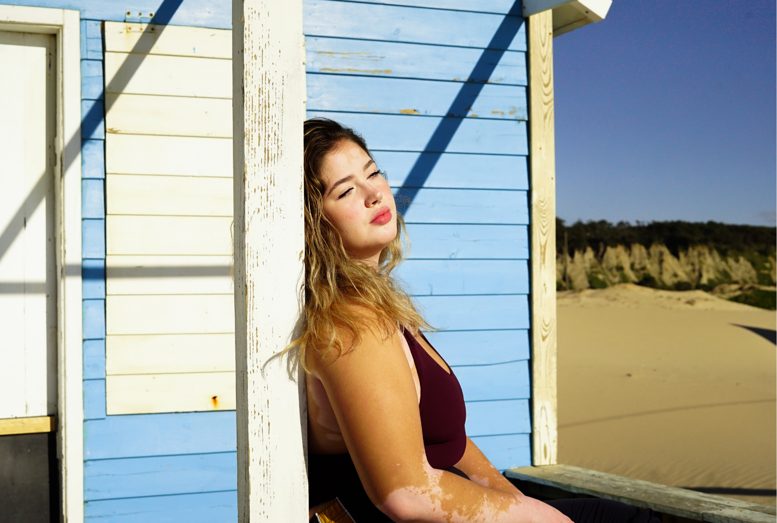 What Does Eating Disorder Recovery Actually Look Like?