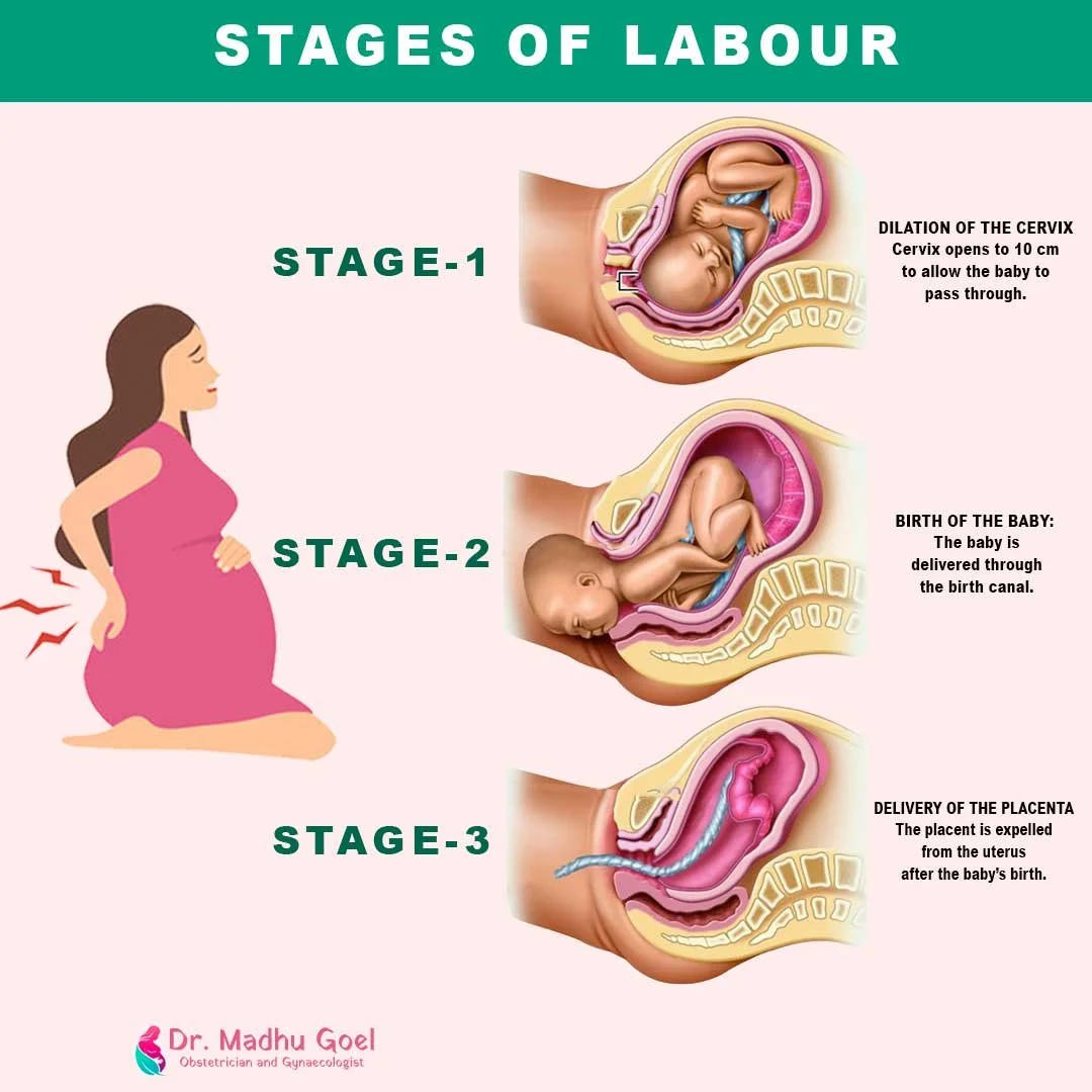 Stages of Labor: A Doula’s Involvement