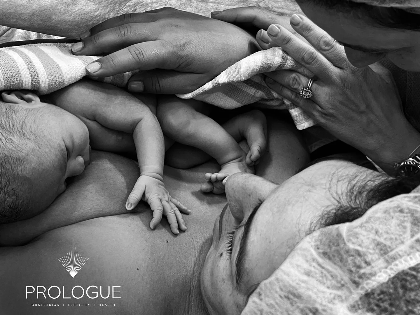 Baby Allegra delivered by Prologue on 8th October 2025, wrapped in the arms of her two amazing mums.

Roz and Electra, thank you for letting us share in this chapter of your brilliant story.

#obstetrician #obstetrics #newborn #pregnancyjourney #preg