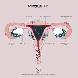 Managing your Endometriosis with Movement | Exercise Physiology Brisbane