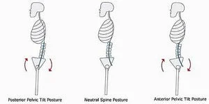 Why It's Important To Know Your Type Of Posture by Claudia Massa