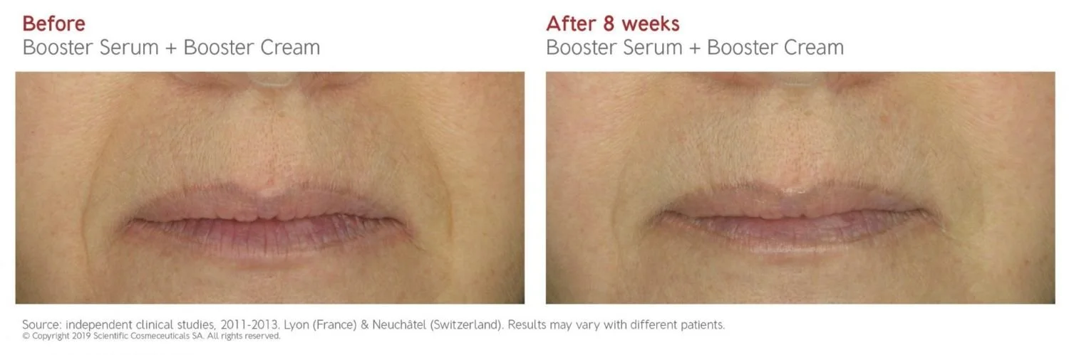 Dr. Levy Booster Cream | Aesthetic Klinik