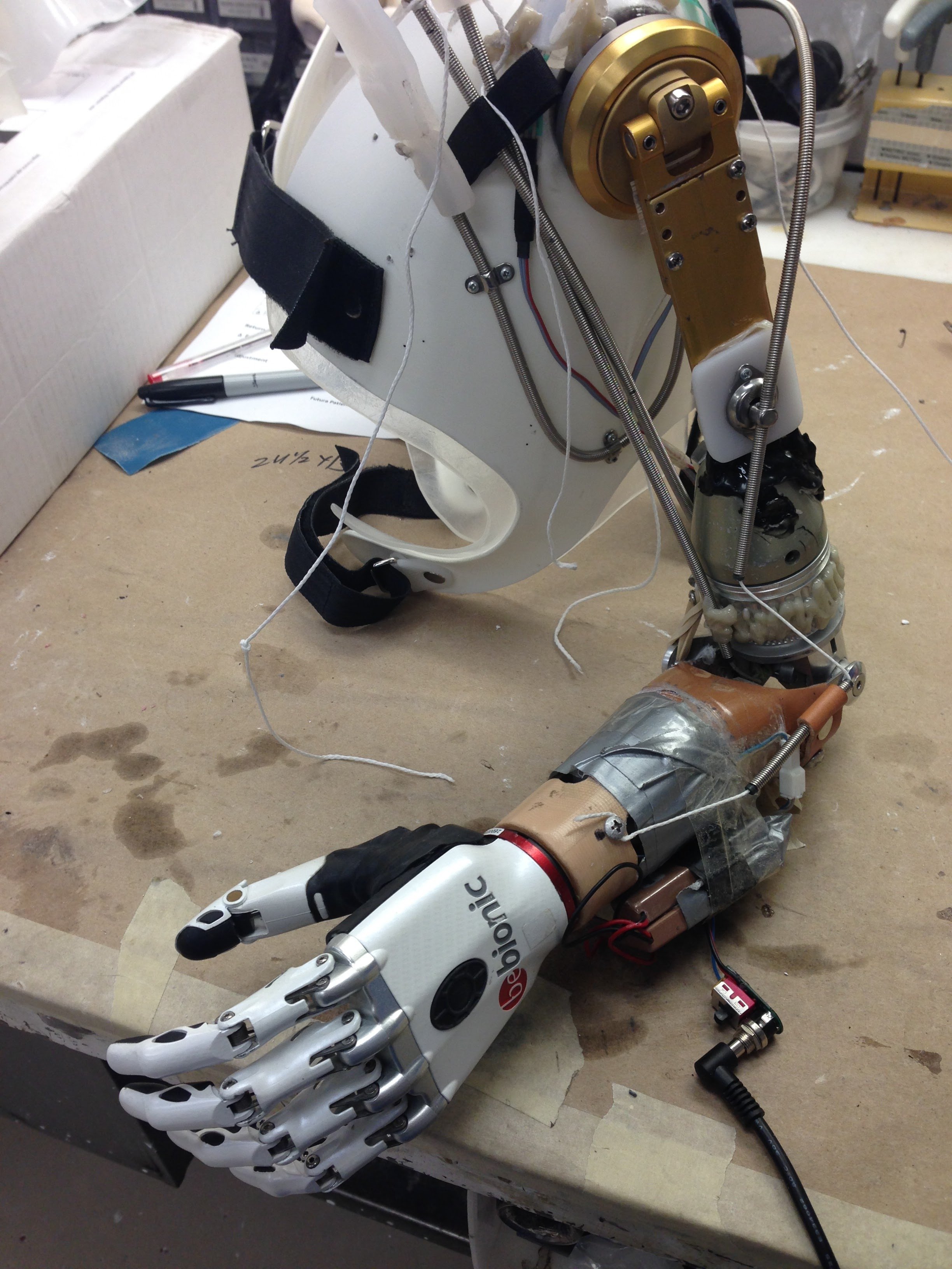Proshtetic arm with electronic components