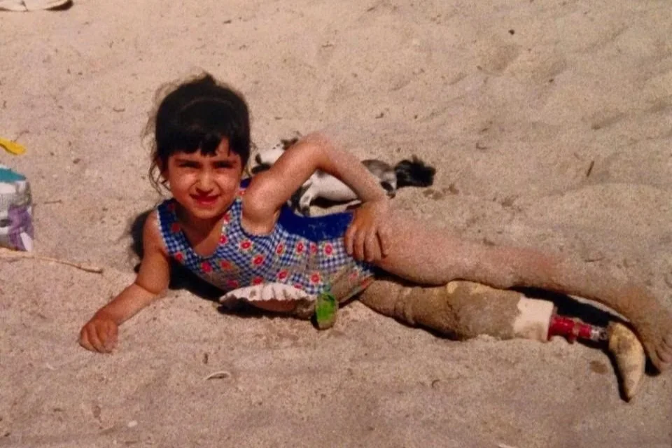 Young child laying in the sand on a beach with a below knee prosthesis.