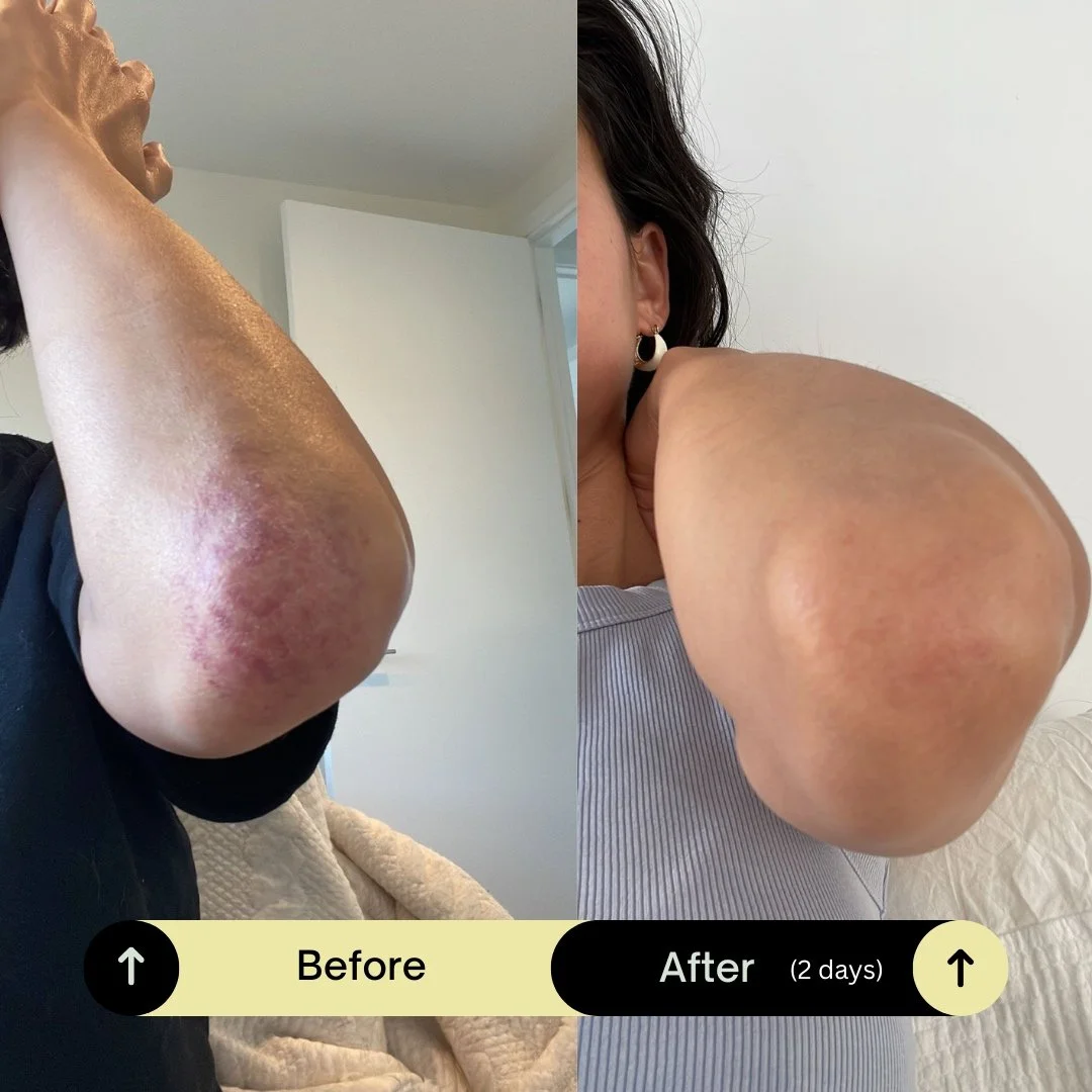  Psoraisis before +after.jpg
