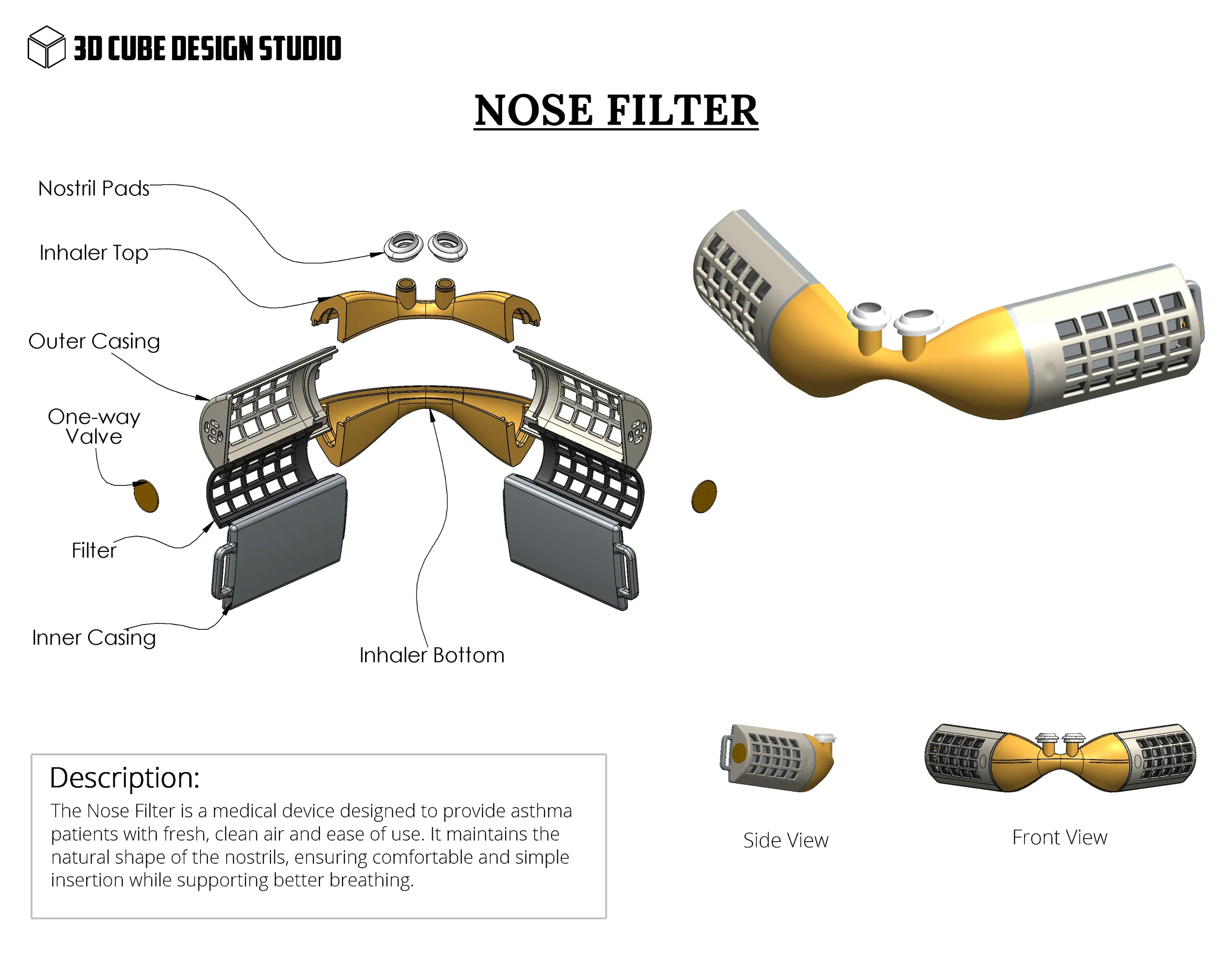 Diagram of a nose filter for asthma patients, showing components such as nostril pads, inhaler top, outer casing, one-way valve, filter, inner casing, and inhaler bottom, with a side and front view of the assembled device and a description of its purpose.