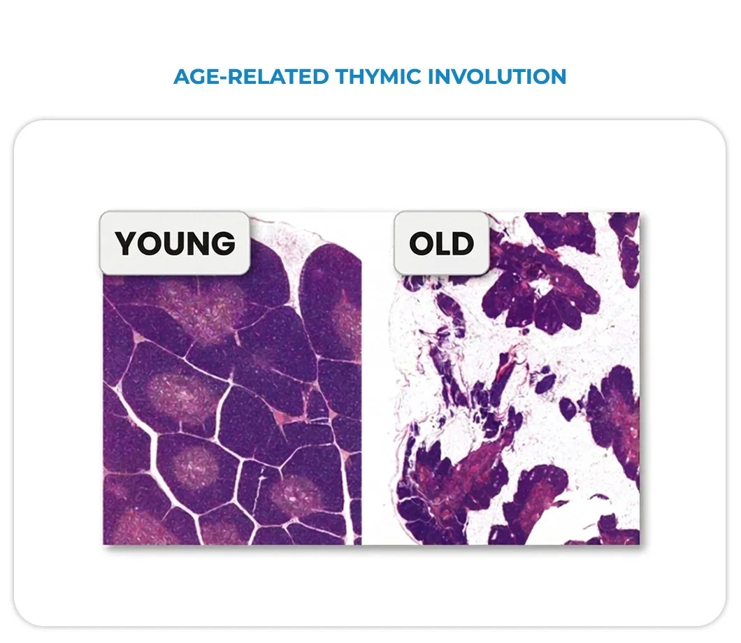 Comparison of tissue samples showing age-related thymic involution, with a young thymus on the left and an old thymus on the right, both stained purple.