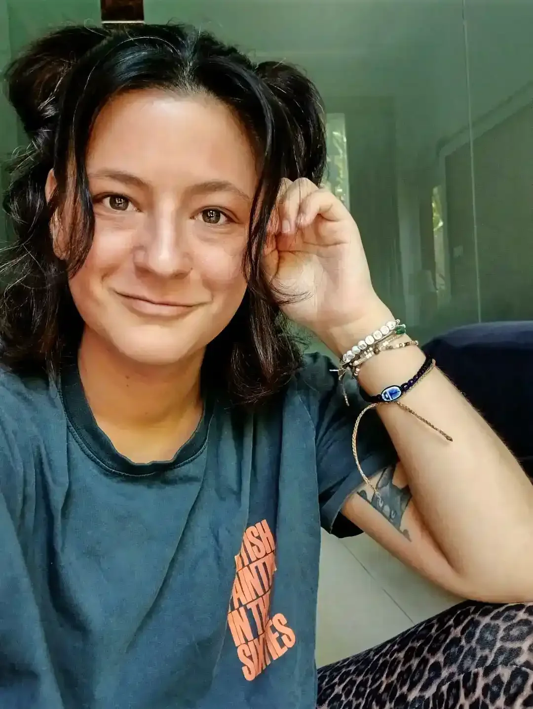 Annina’s TSW Journey: From Thailand CAP Treatment to Healing in Bali