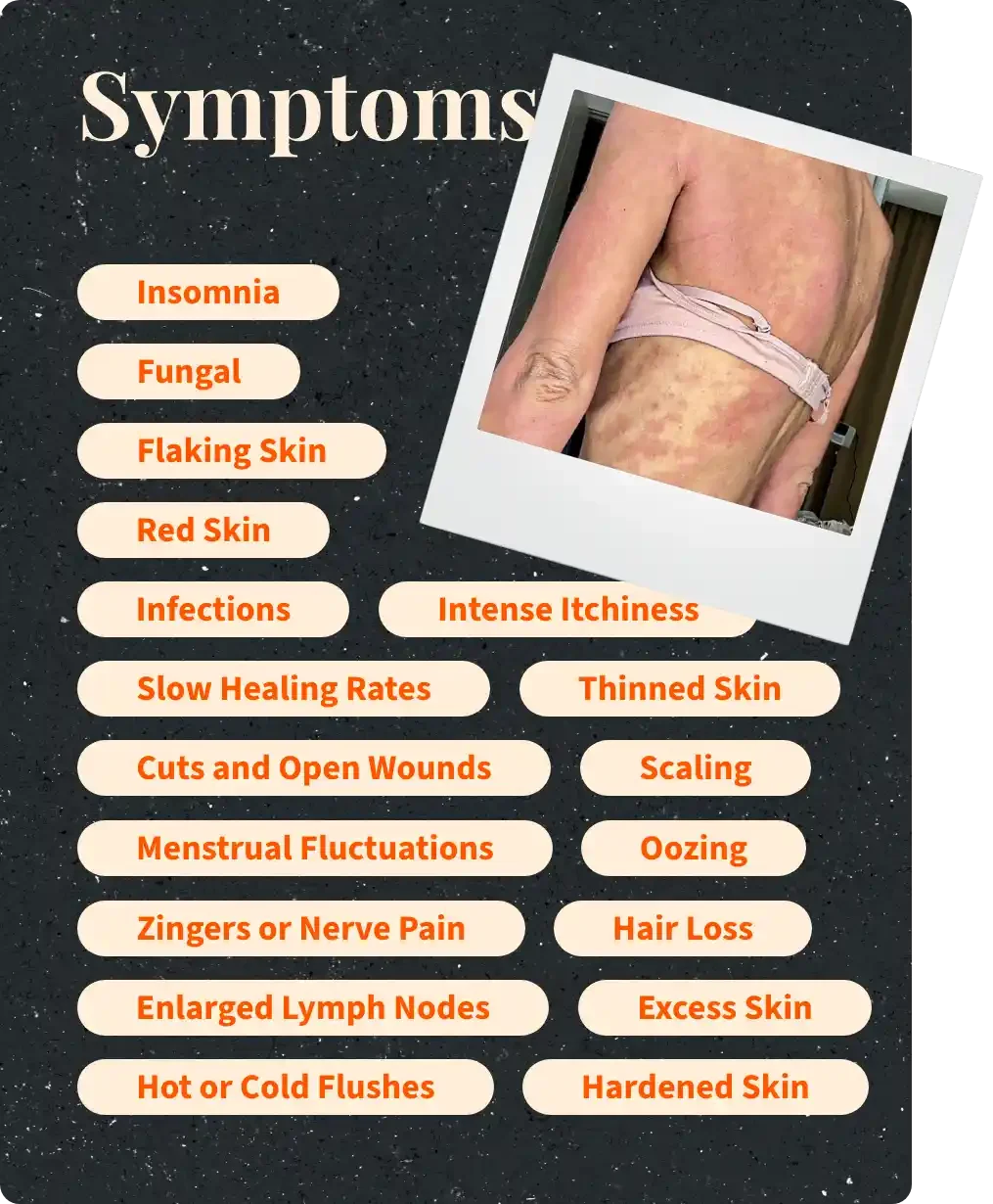 tsw symptoms card, insomnia, fungal, flaking skin, red skin, infections, intense scratching, slow healing rates, oozing, hair loss, cuts, open wounds