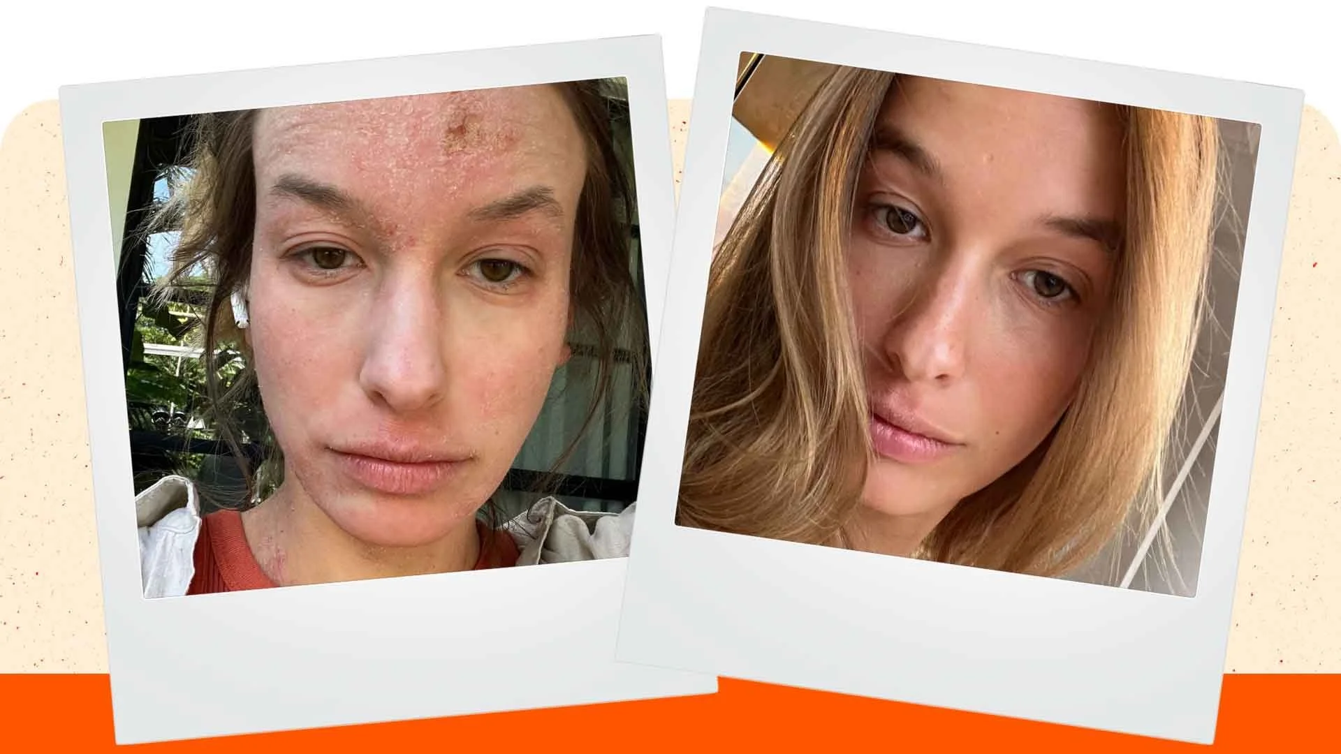 Young female Anna before and after TSW