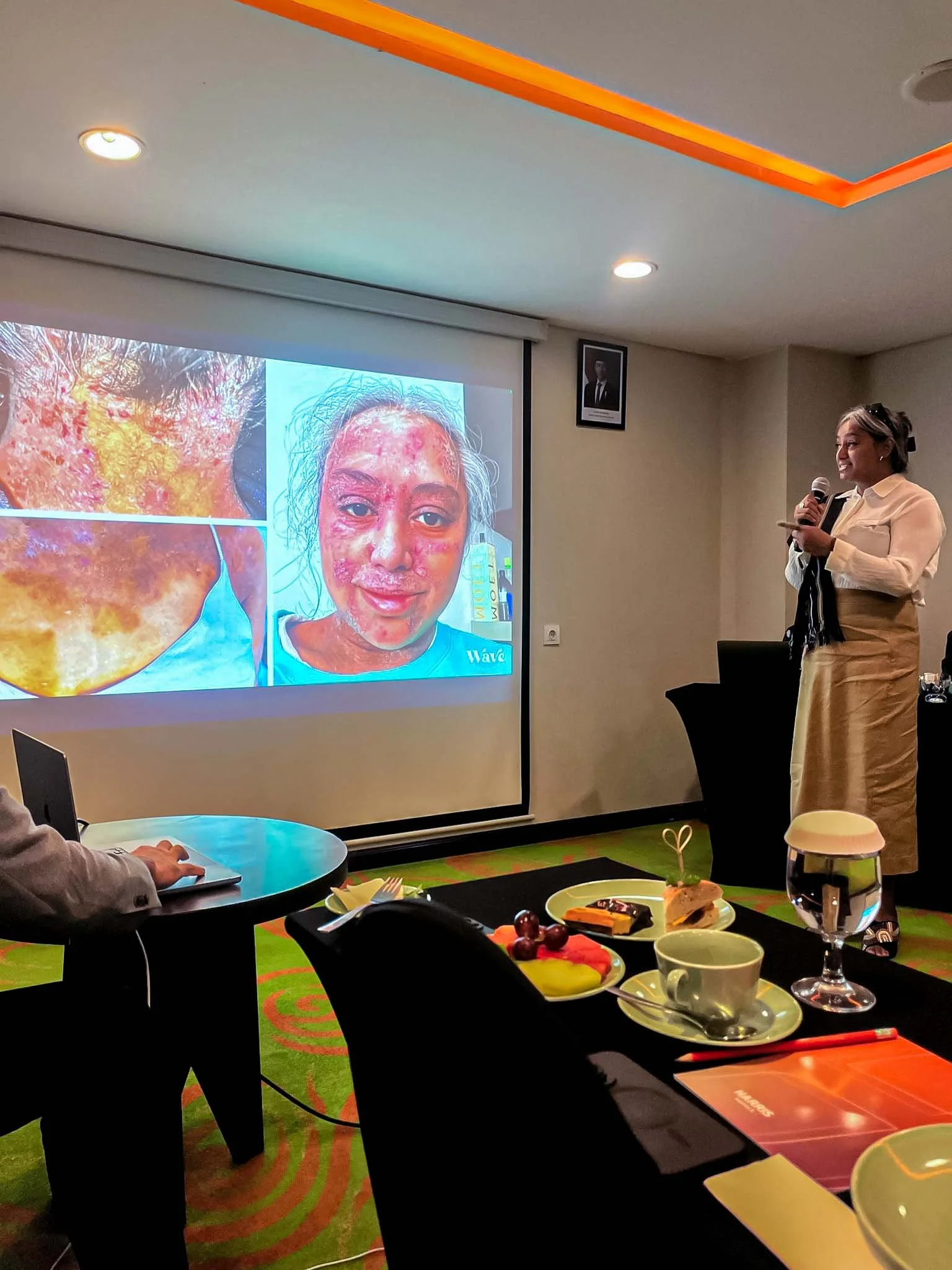 Inspection of Ministry of Health Indonesia about collective commitment to enhance support and treatment for Topical Steroid Withdrawal | Red Skin Syndrome skin conditions