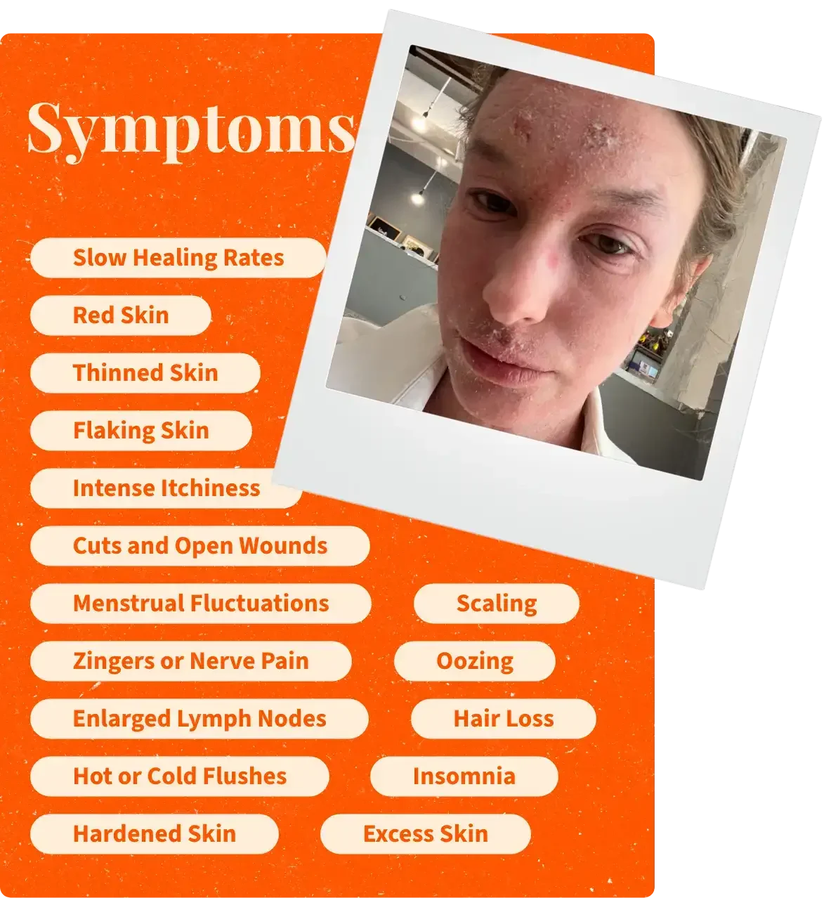 TSW | Red Skin Syndrome Symptoms