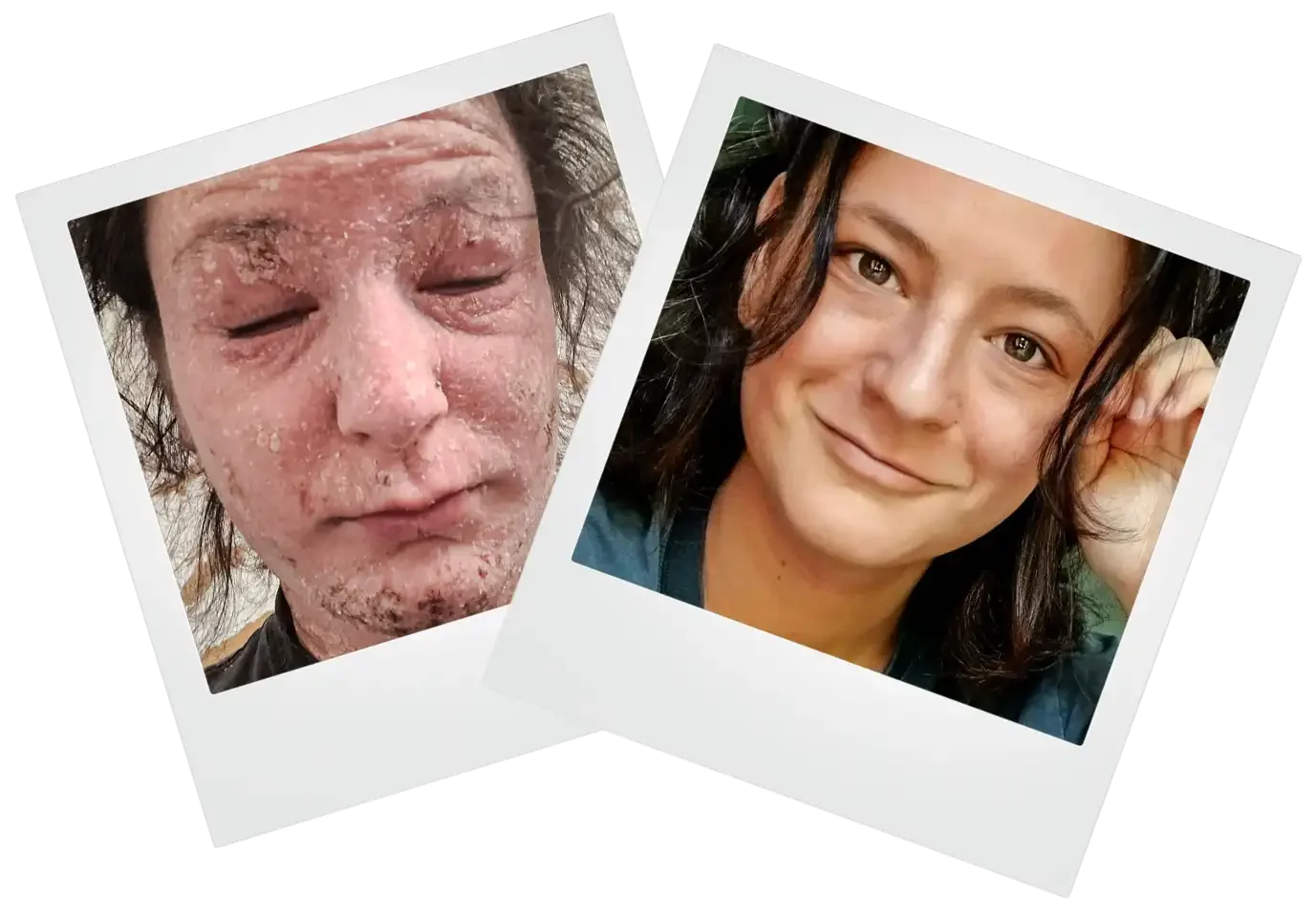 TSW Recovery of Annina, Before and After instax