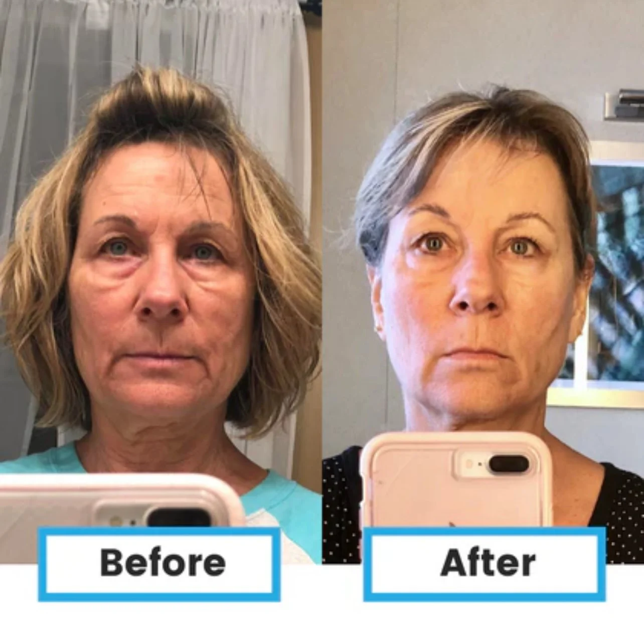 View recent photos.jpeg