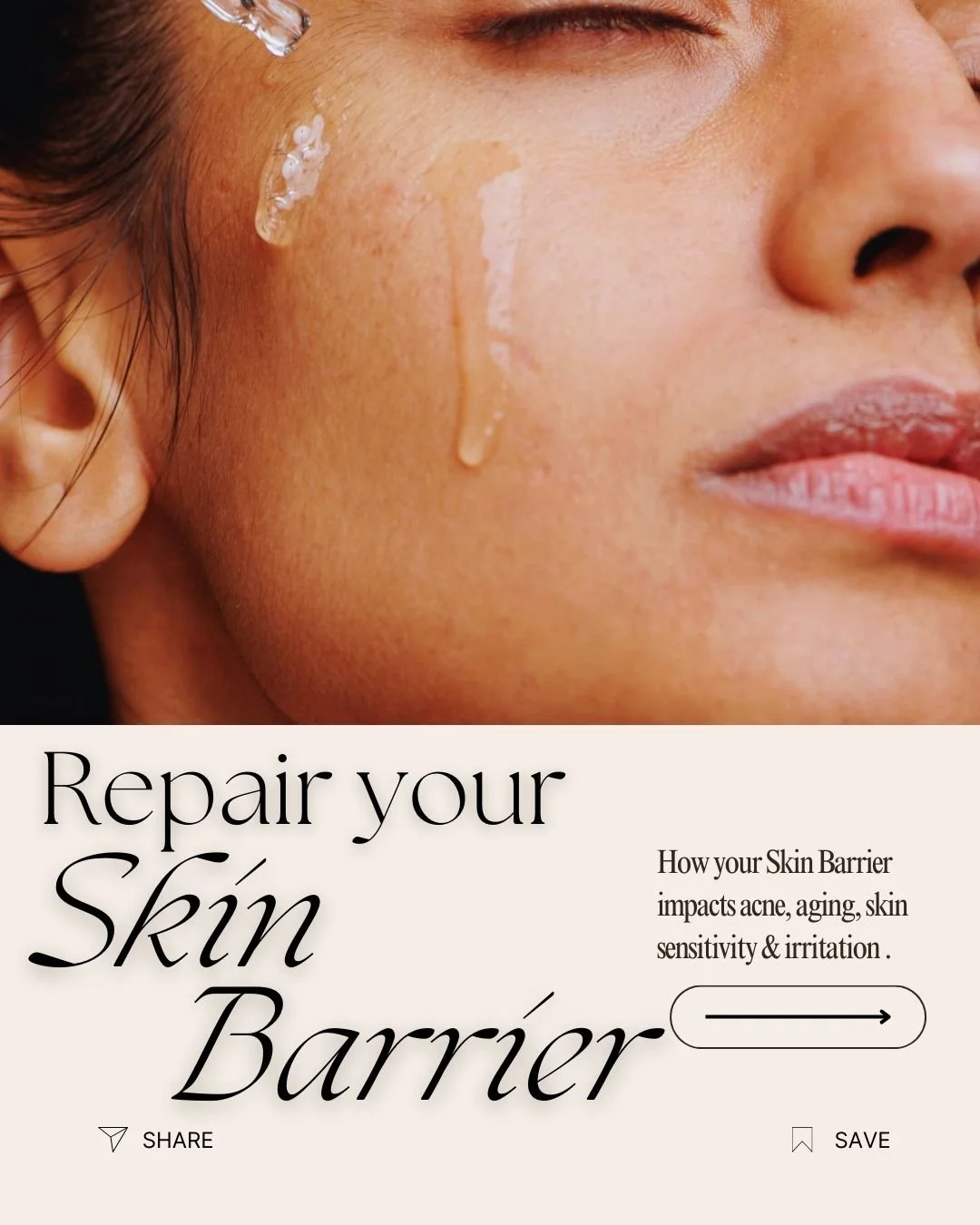 Your skin barrier isn&rsquo;t fragile, but it is dramatic. 💅
Ignore it, and suddenly you&rsquo;ve got breakouts, wrinkles, and skin that throws a tantrum over moisturizer. The fix? Learn how to repair it before it spirals.

✨ Swipe to see how your b