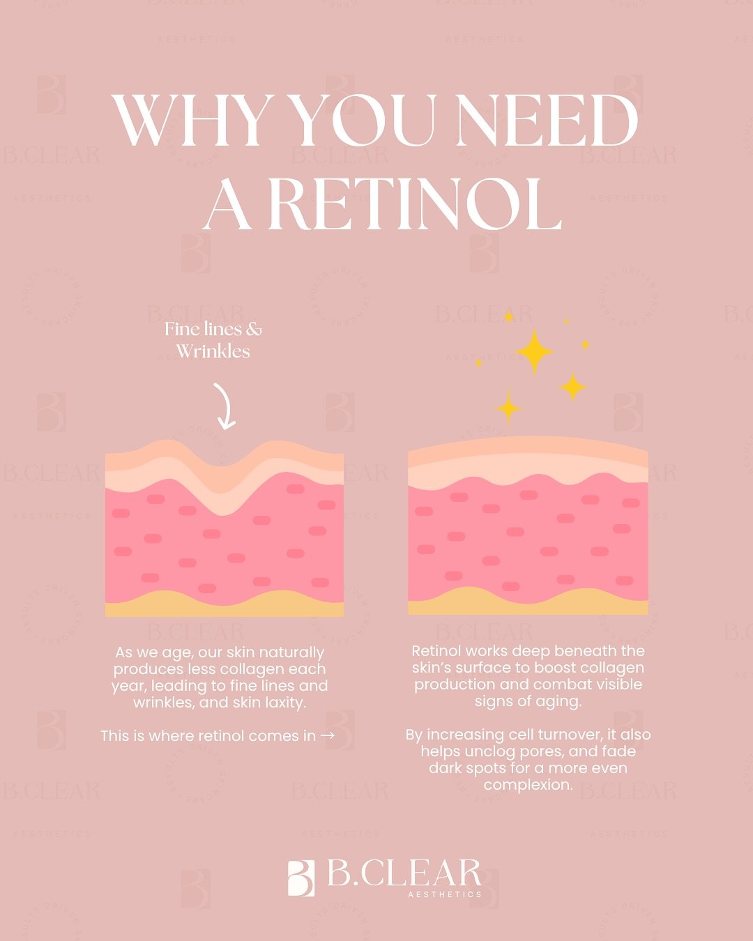 Happy National Retinol Day! ✨ 

Retinoids and retinols increase cellular turnover, which allow our skin to regenerate more quickly, leading to a glowing, more vibrant appearance. It&rsquo;s like a fresh start for your skin. 

Patience is key but resu