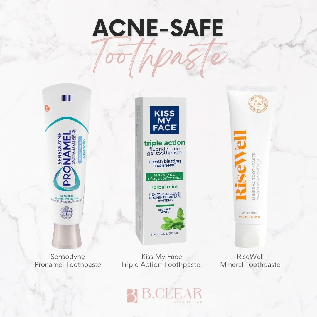 If you&rsquo;re noticing acne around your mouth or chin, your toothpaste could be a hidden trigger❕

Many toothpastes contain pore-clogging ingredients, a common one is SLS (sodium lauryl sulfate), and may be contributing to breakouts in this area. 
